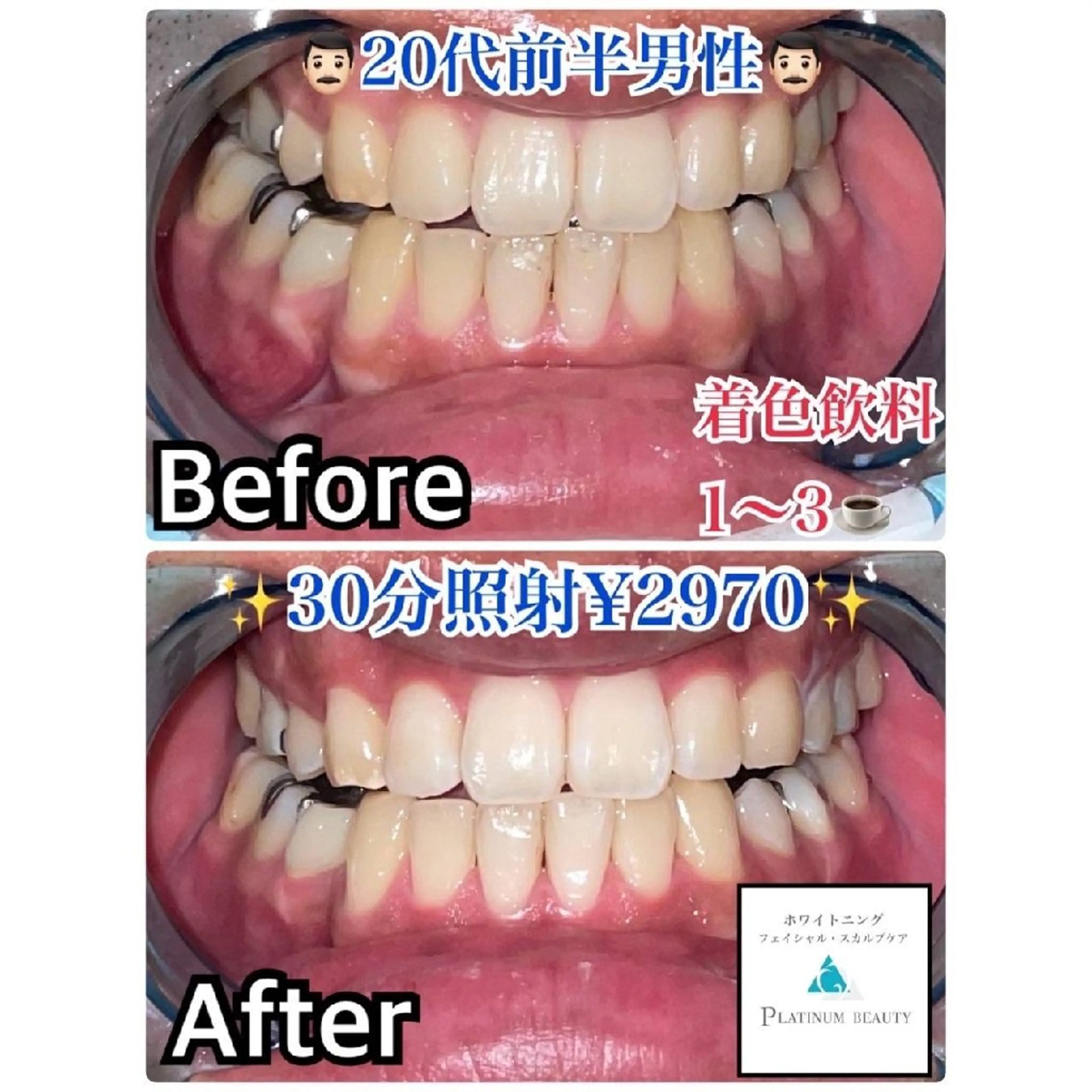 セルフホワイトニングビューティー三川店所属・中村 江梨香のその他イメージ