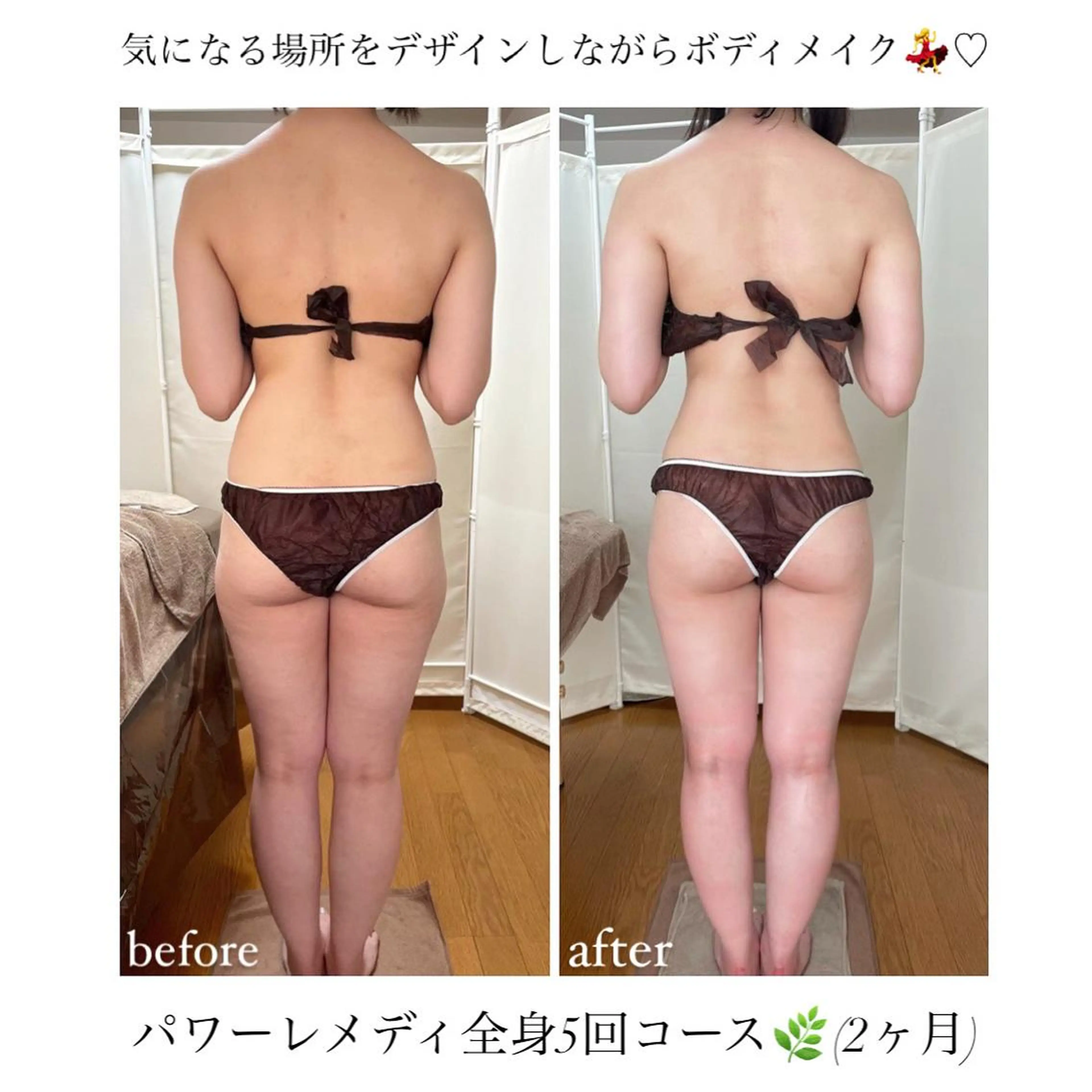 biloop所属・《本気痩せ×疲労改善 》  BILOOPのエステ・リラクイメージ