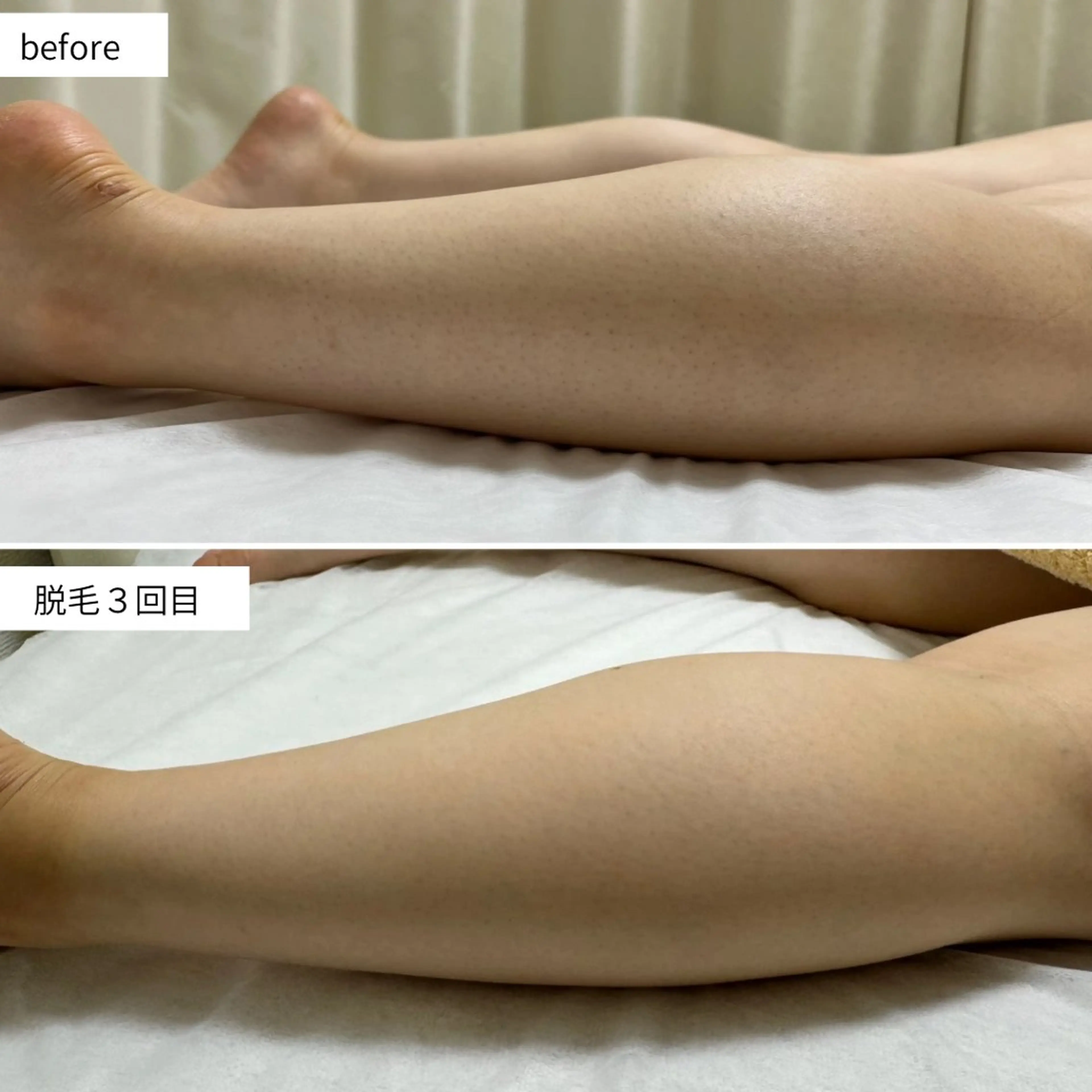 シミ・毛穴ケア専門 クロヌYUKIのエステ・リラクイメージ