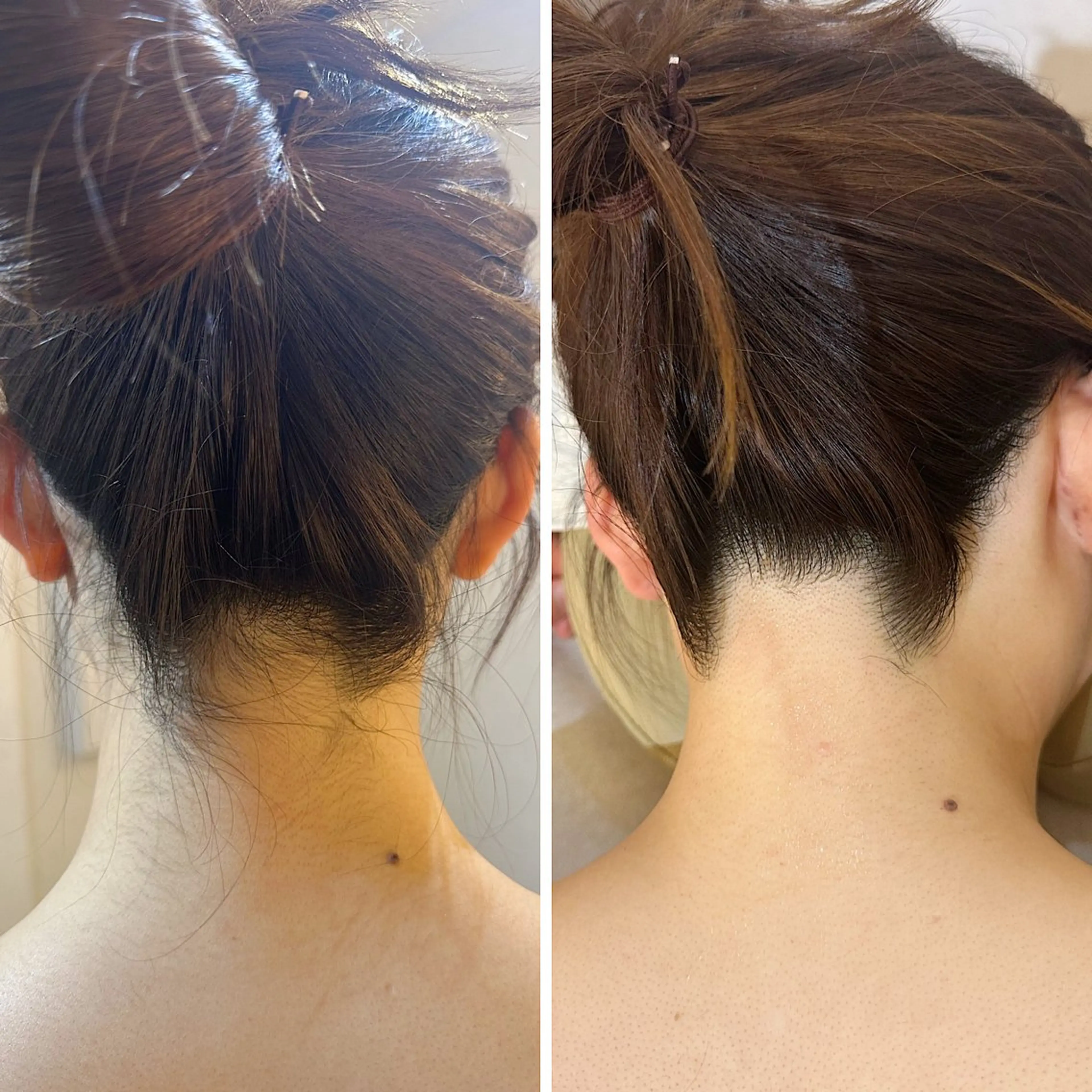 脱毛 うなじ脱毛/美肌脱毛 LABELのエステ・リラクイメージ