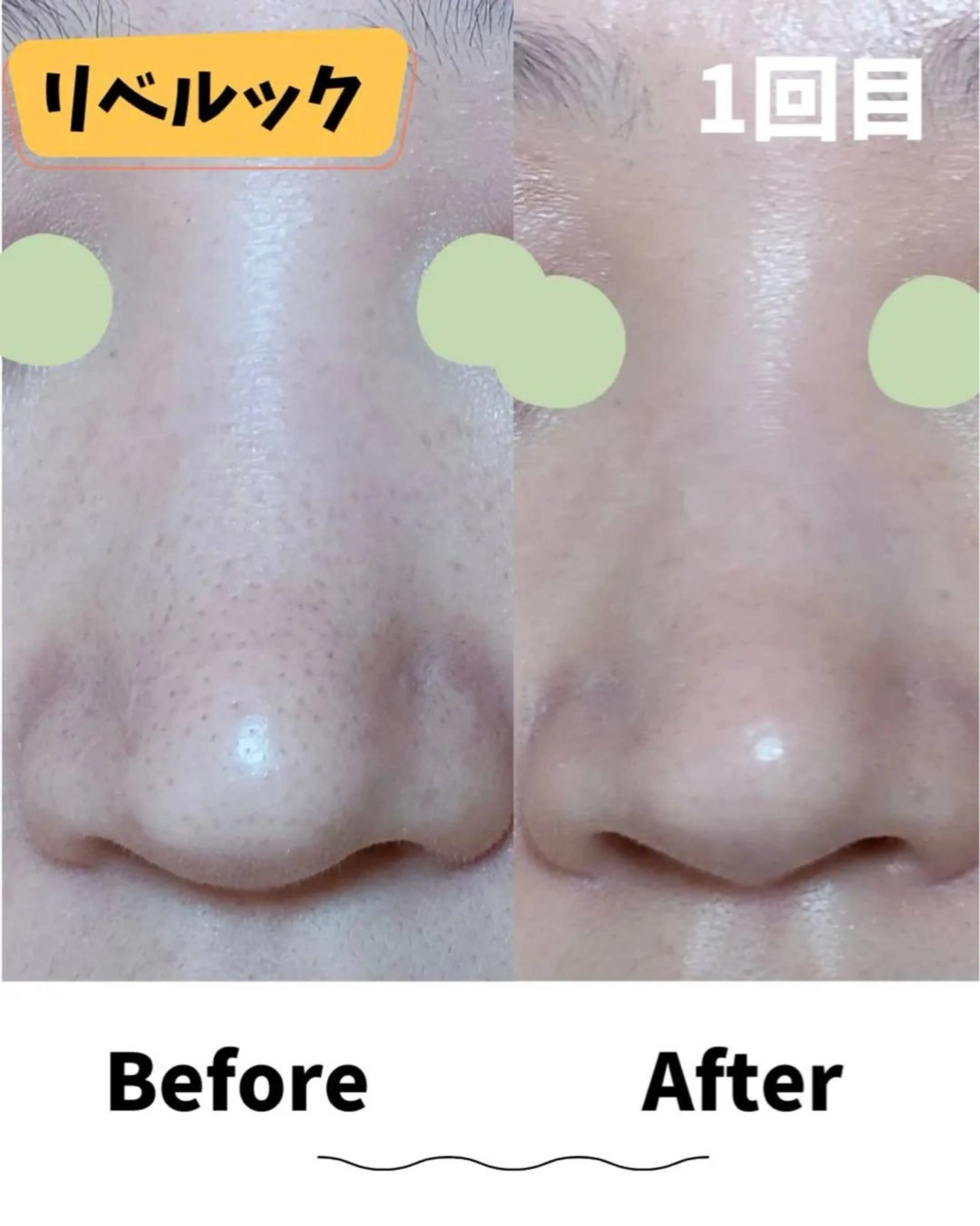 エステ コンセプトサロン〜友〜所属・コンセプトサロン友 木下のエステ・リラクイメージ