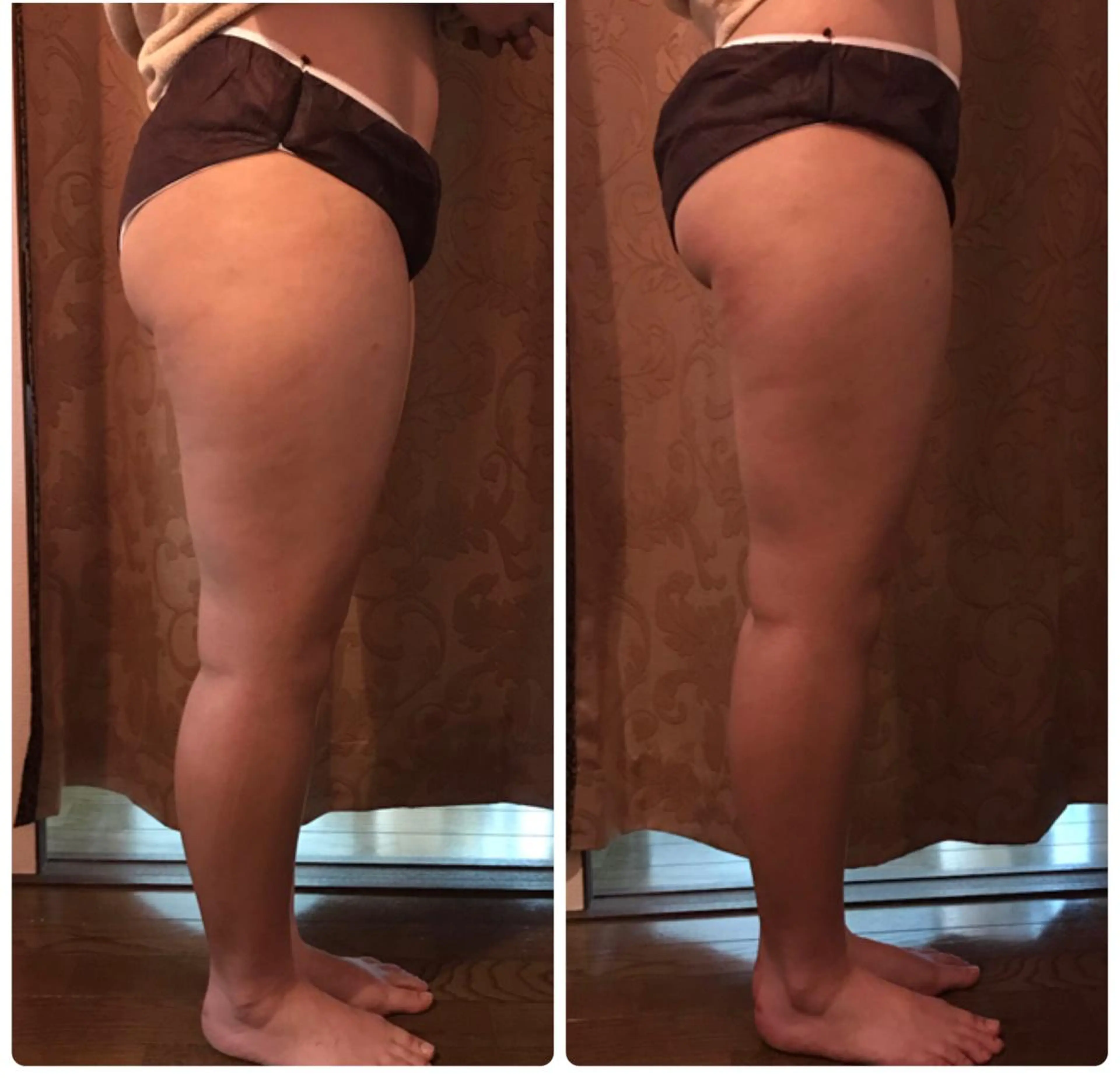 代表 MOMOのエステ・リラクイメージ