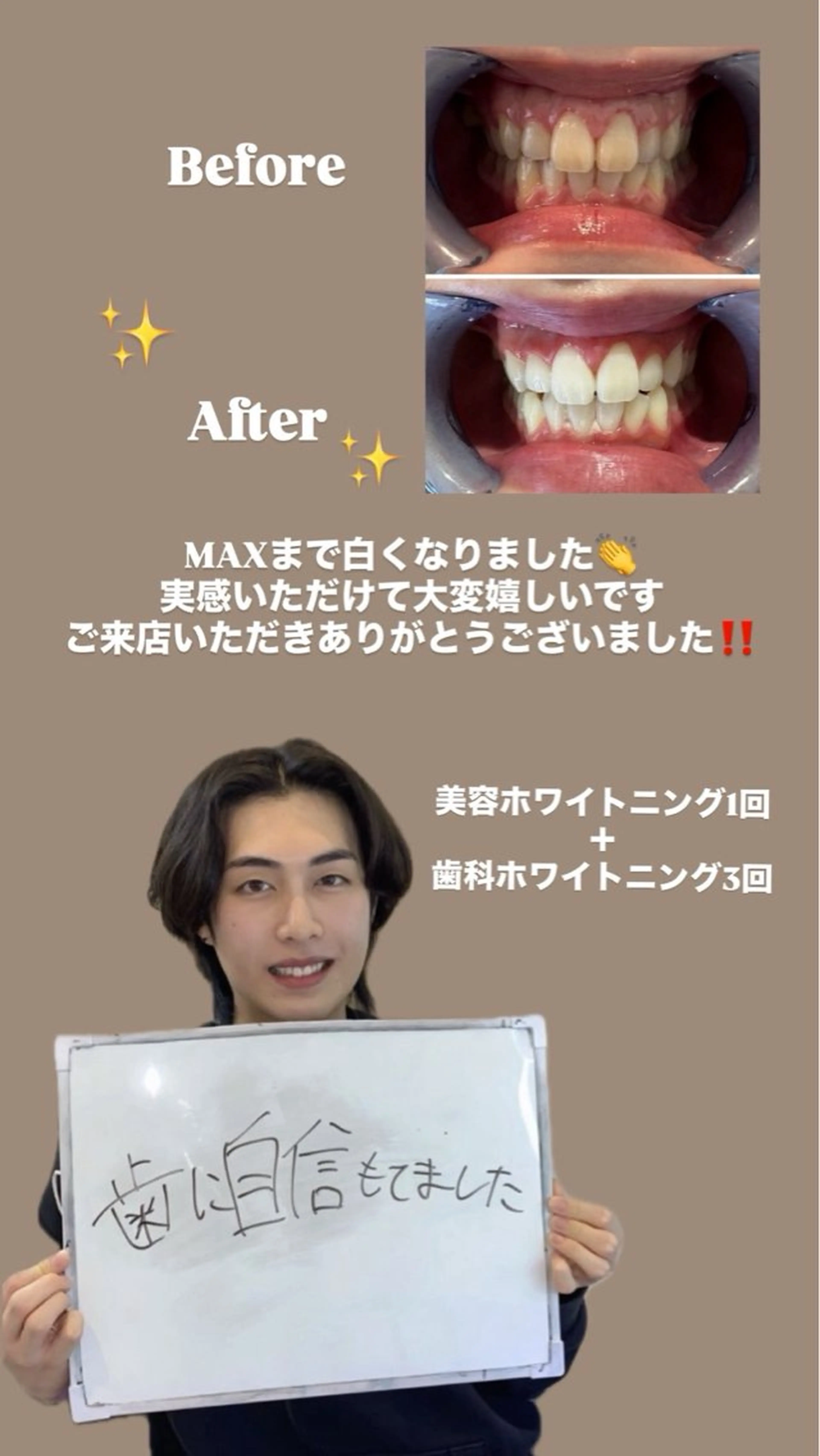 東区香椎歯のセルフホ ワイトニングGLOWのその他イメージ