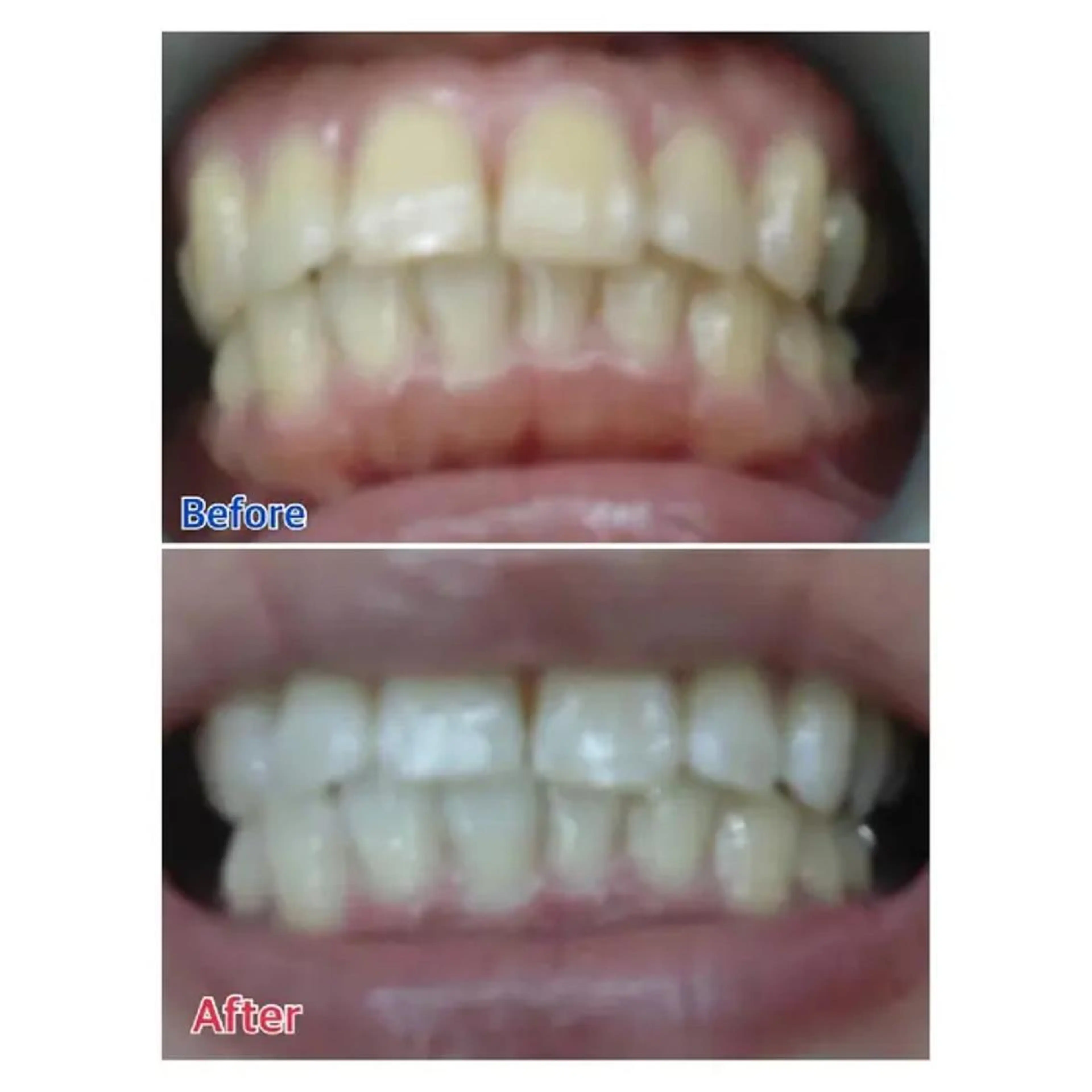 M渋谷 ホワイトニングのエステ・リラクイメージ