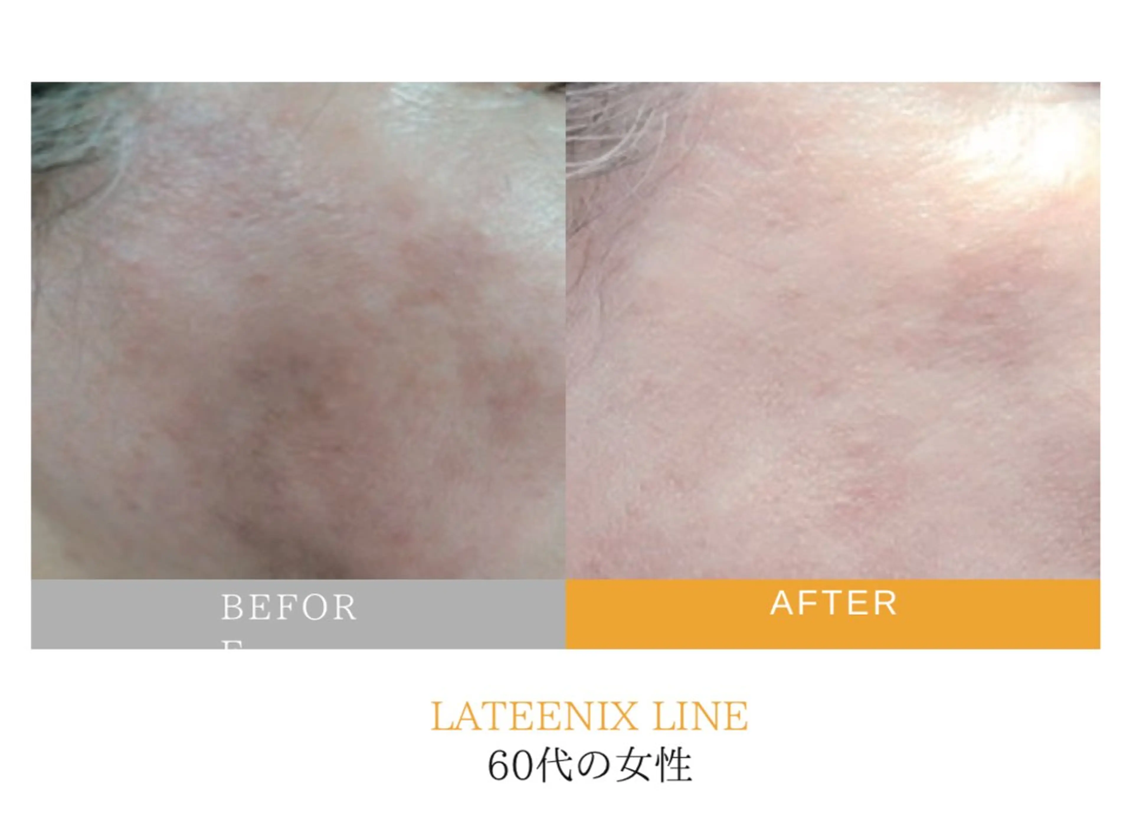 エステ リラク salon aretéのエステ・リラクイメージ