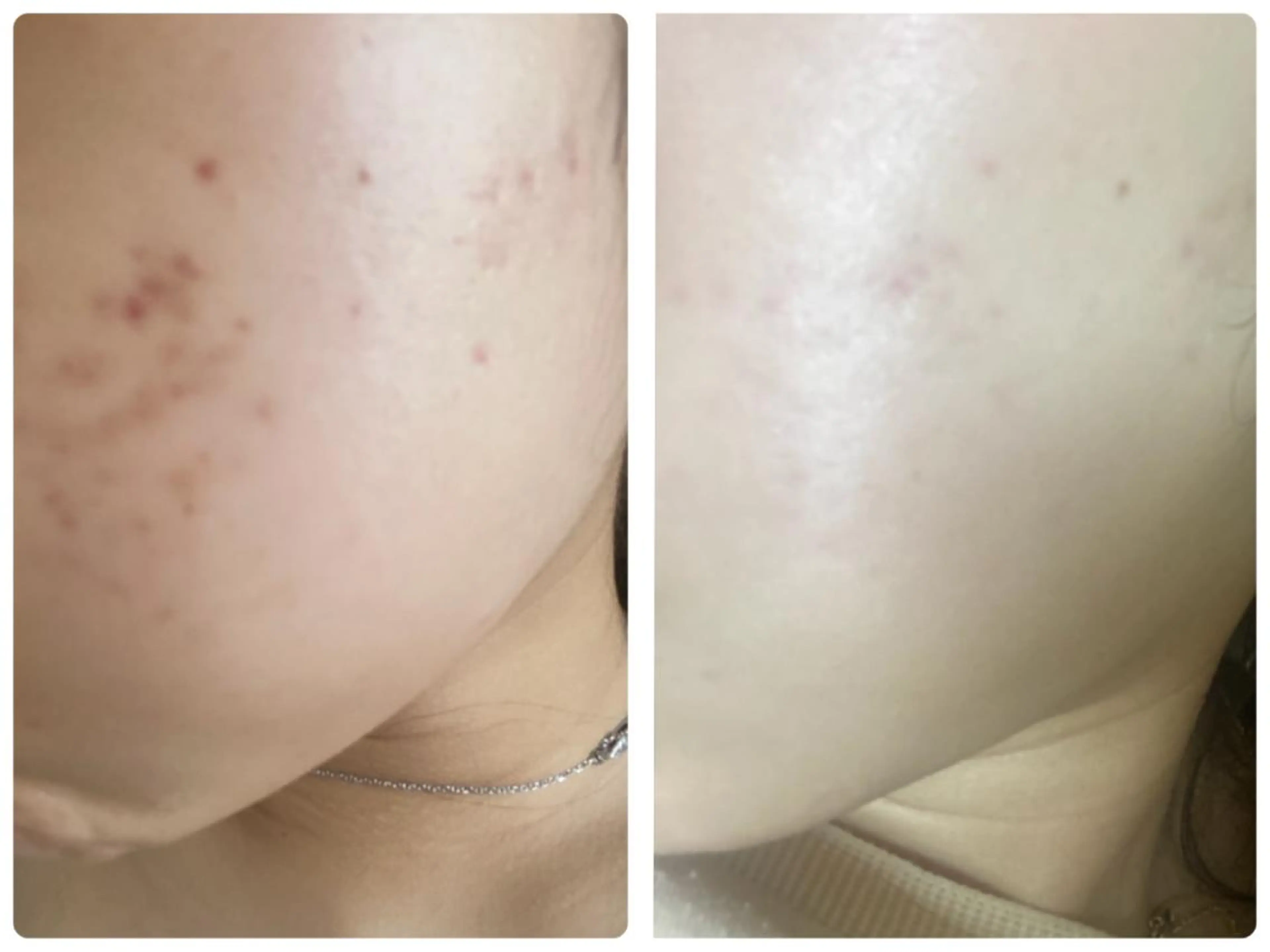 エステ リラク 肌質改善美容サロン ému 用賀のエステ・リラクイメージ