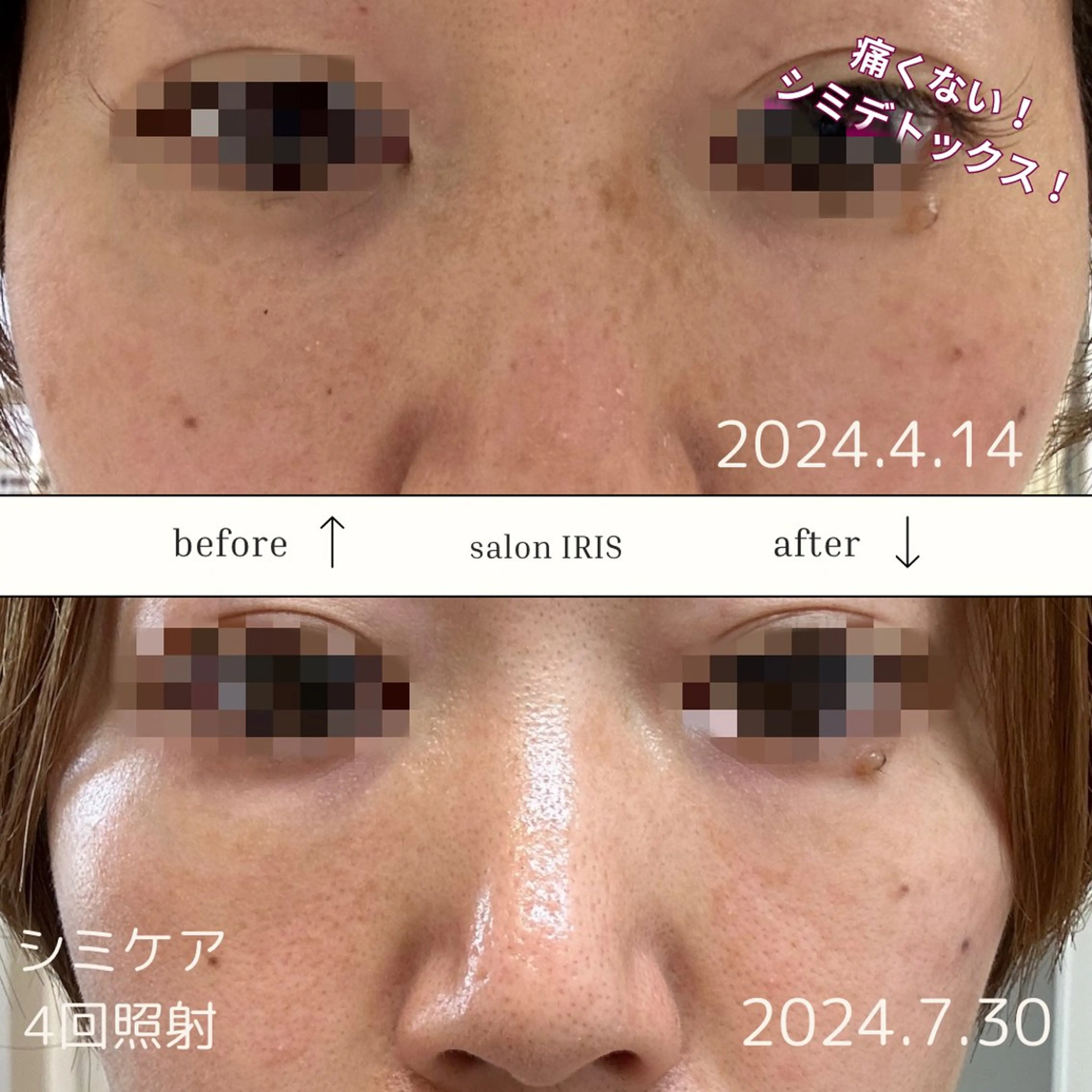 エステ ASAI CHIZURUのエステ・リラクイメージ