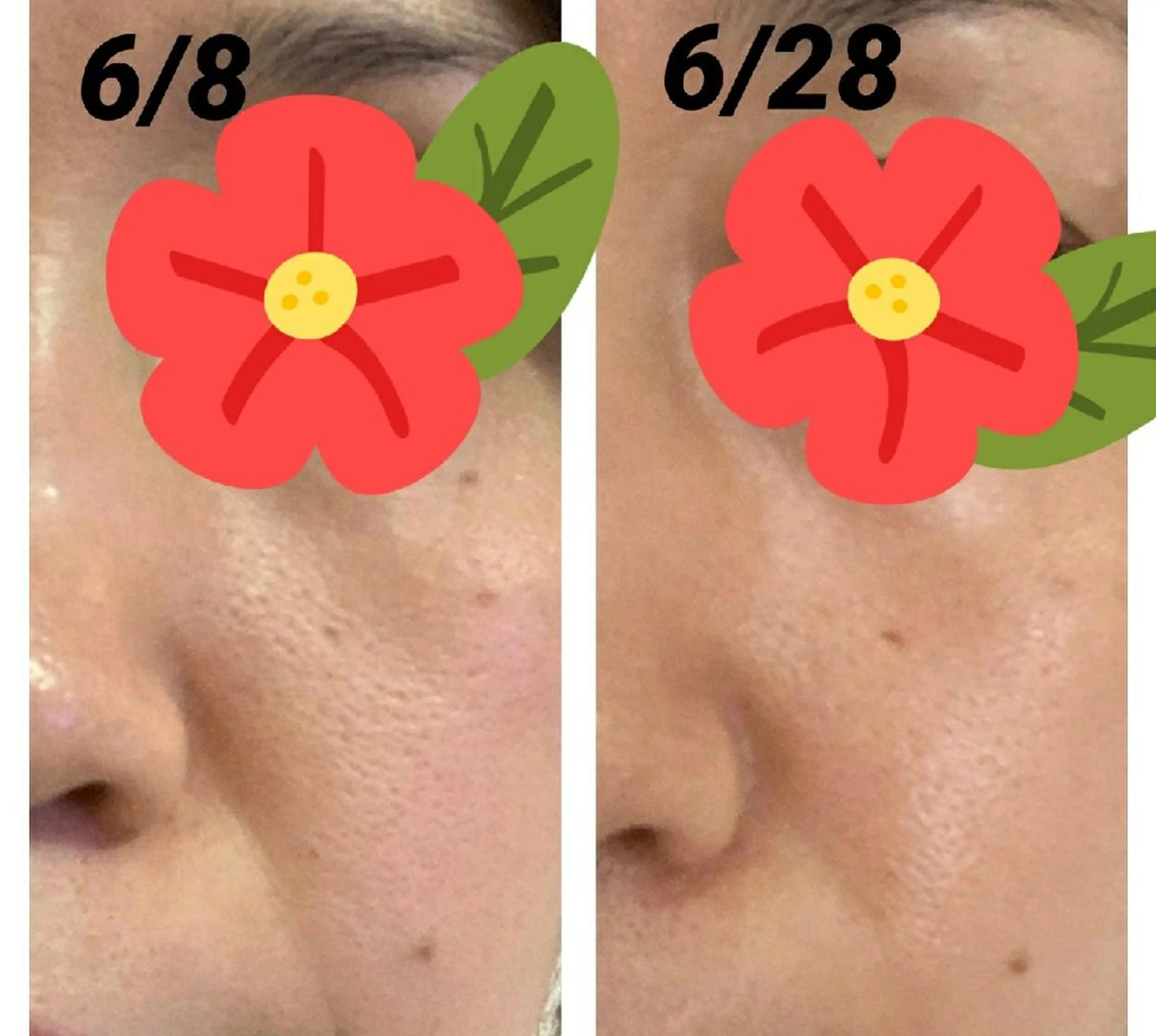 ユテラ 佑來（ゆき）のエステ・リラクイメージ