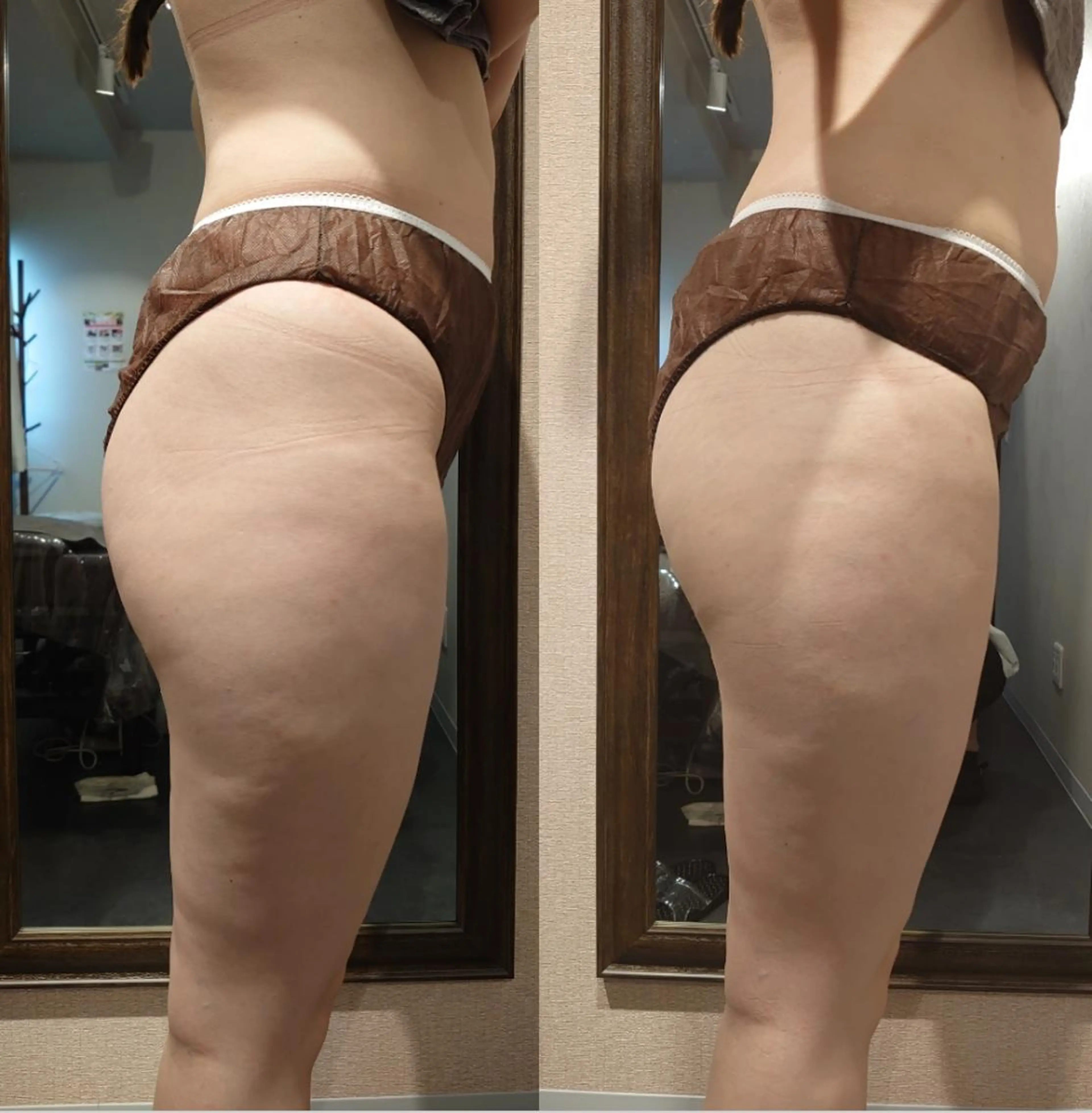 に なのエステ・リラクイメージ