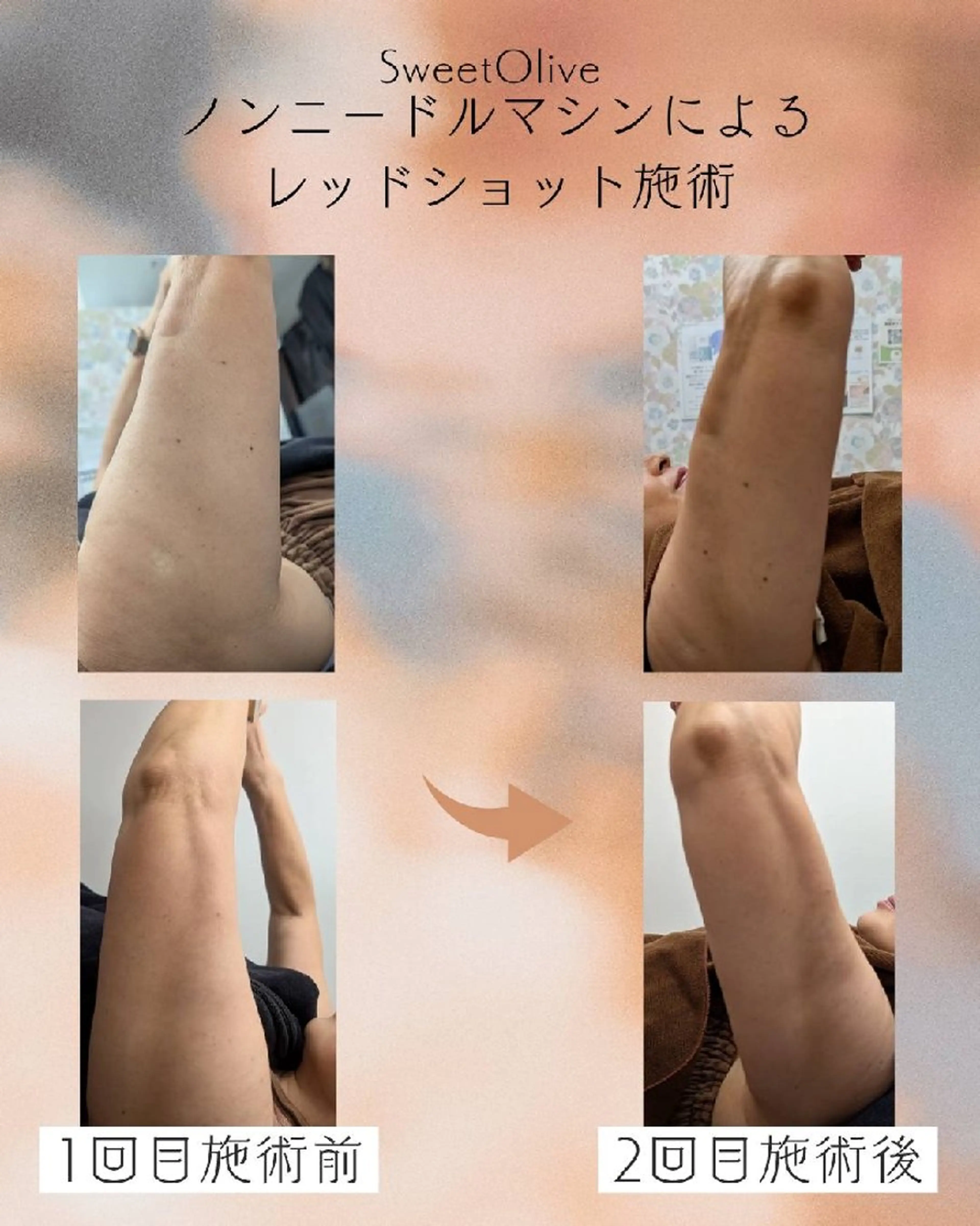 SweetOlive 　 Akaneのエステ・リラクイメージ