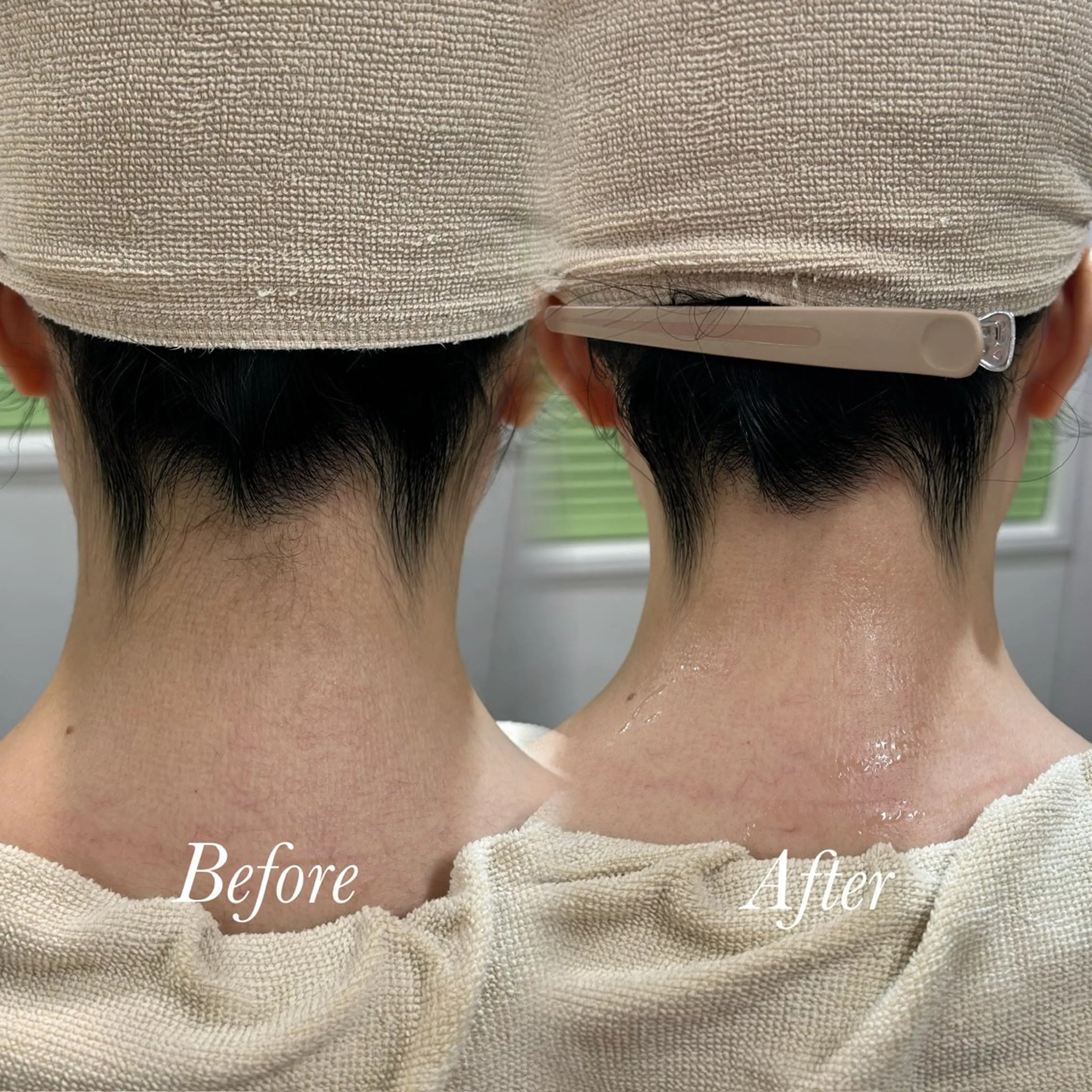 🫧美しい素肌へ🫧 今成柚乃のその他イメージ