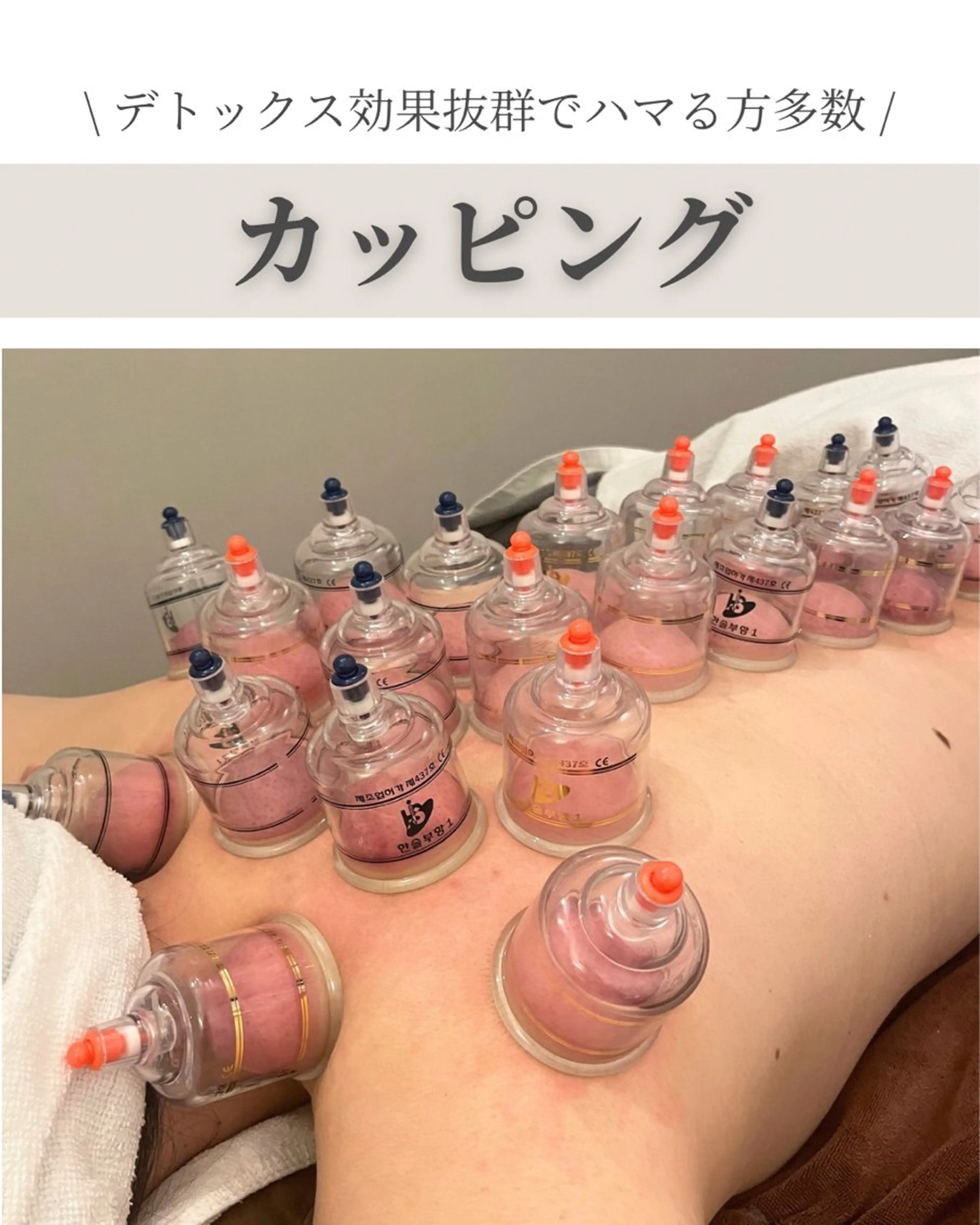 美容鍼/鍼灸 ここみ鍼灸院のエステ・リラクイメージ