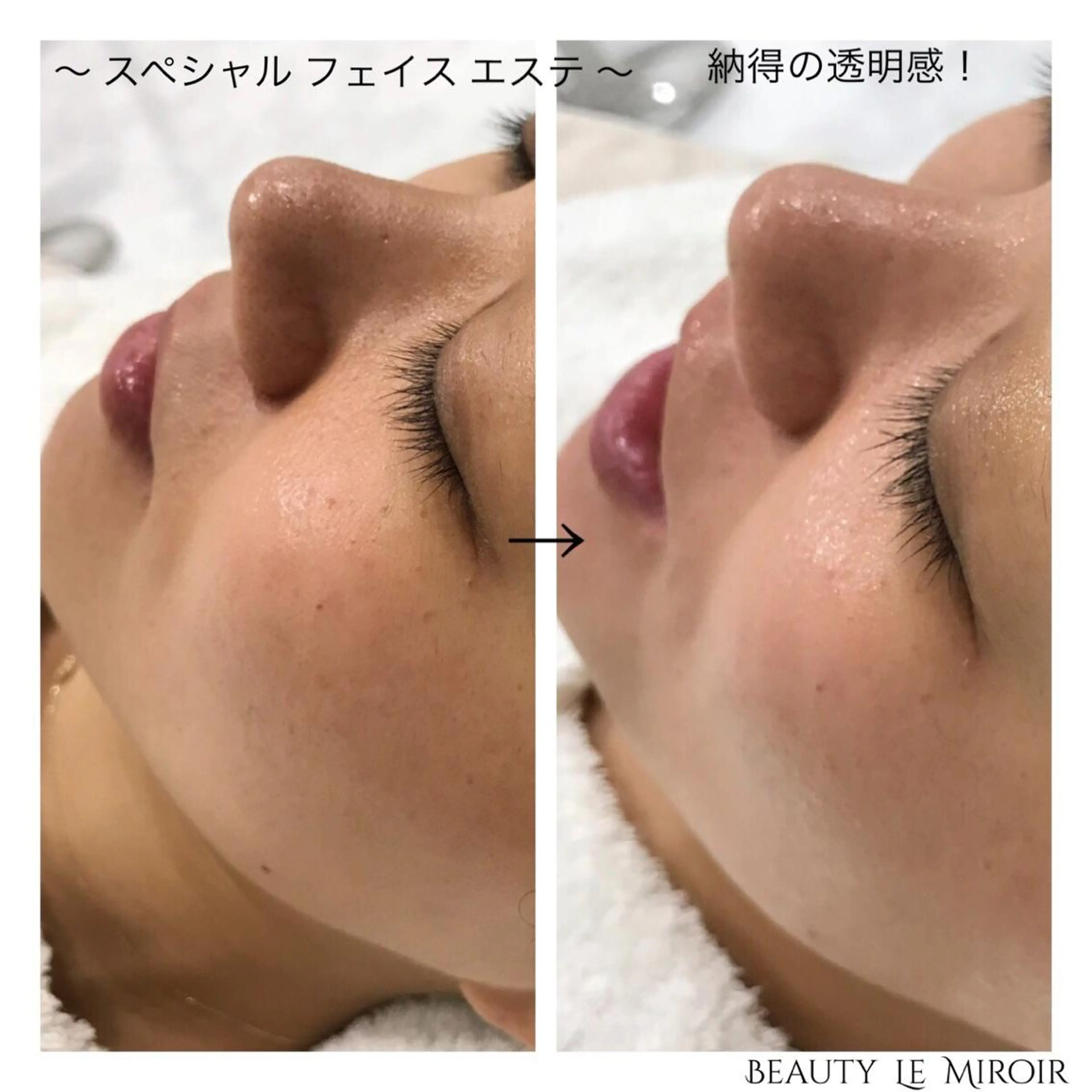 ビューティー ミロワールのエステ・リラクイメージ