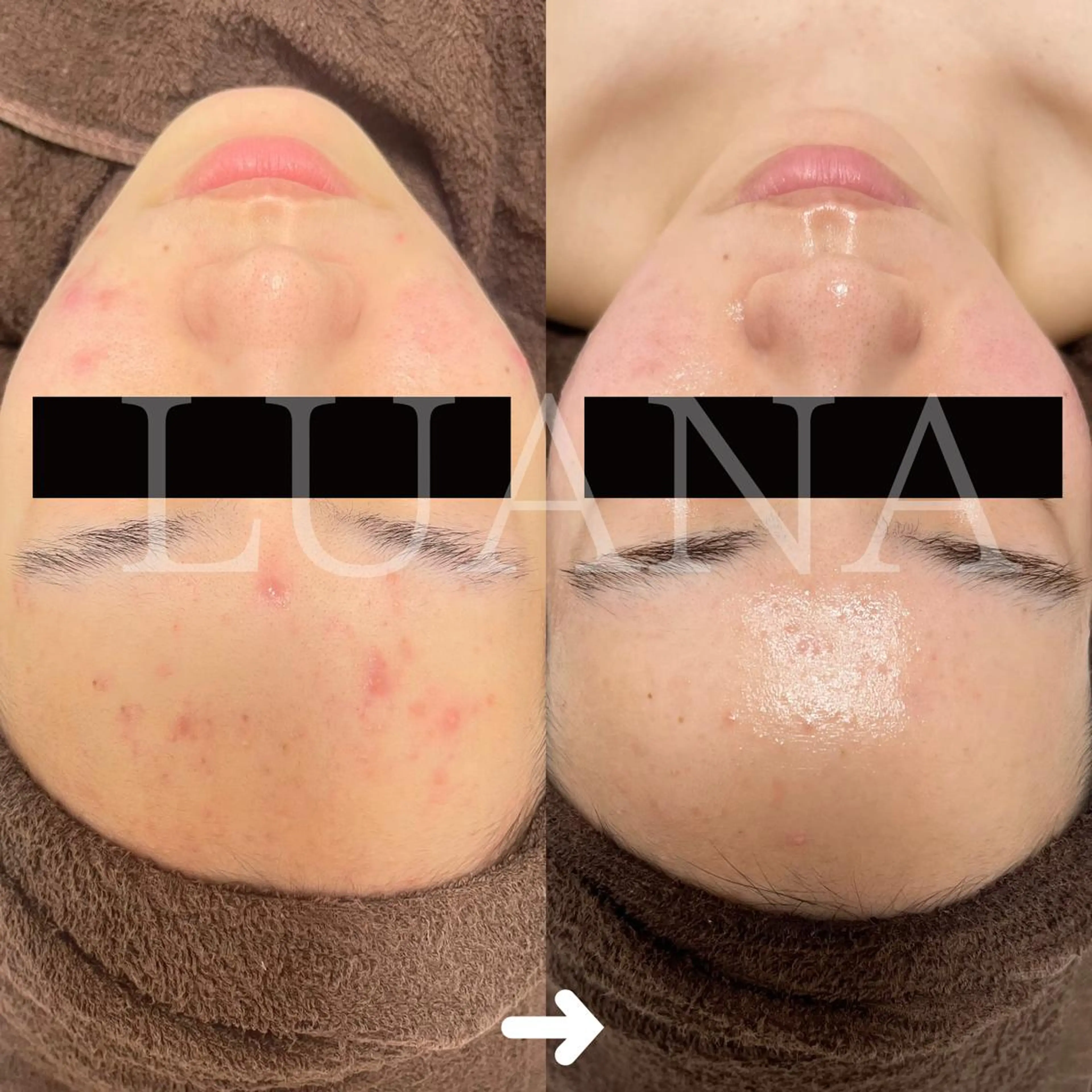 LUANA TAKAGIの眉毛・アイブロウイメージ