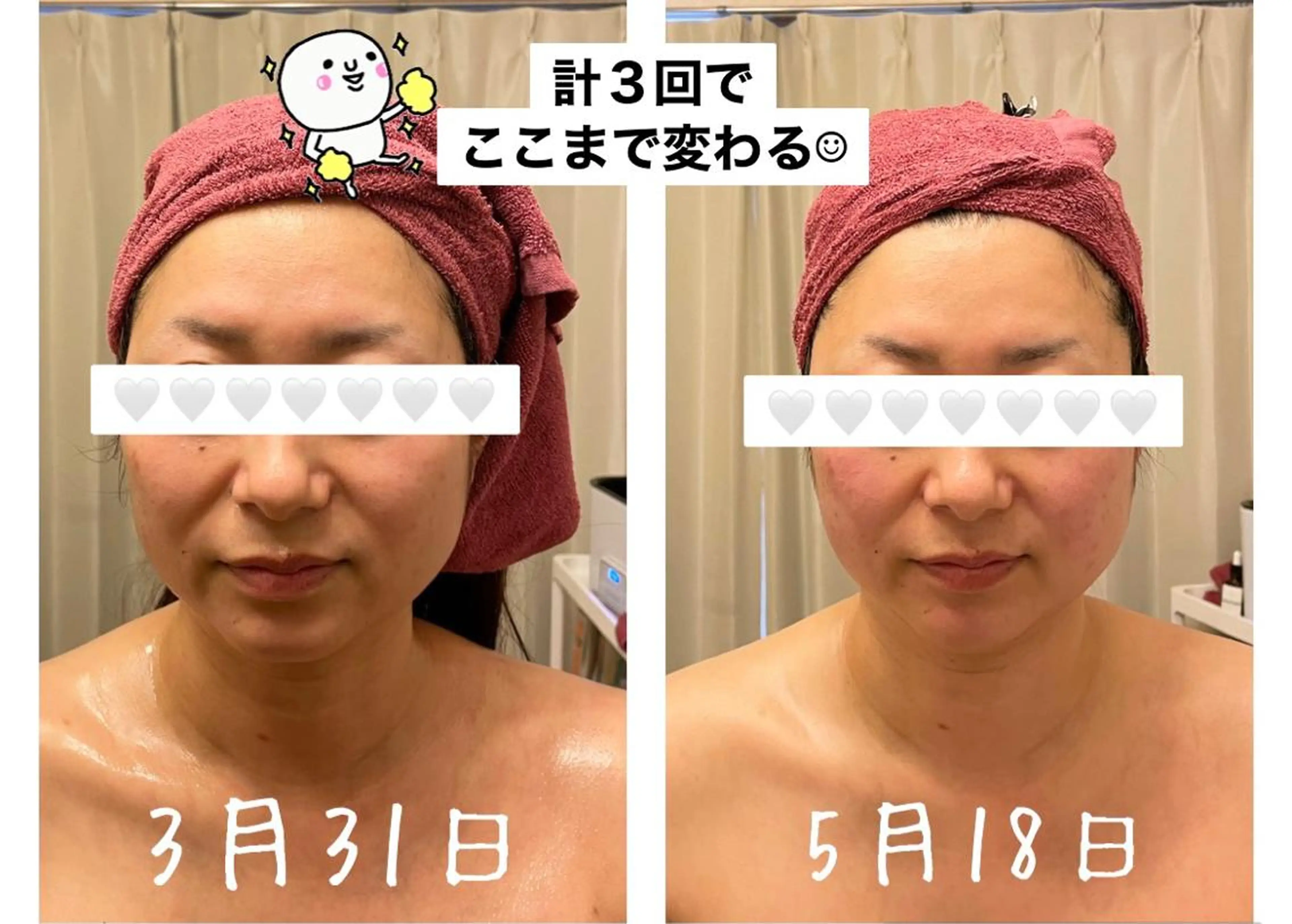 35歳からの エイジングケアサロンのエステ・リラクイメージ