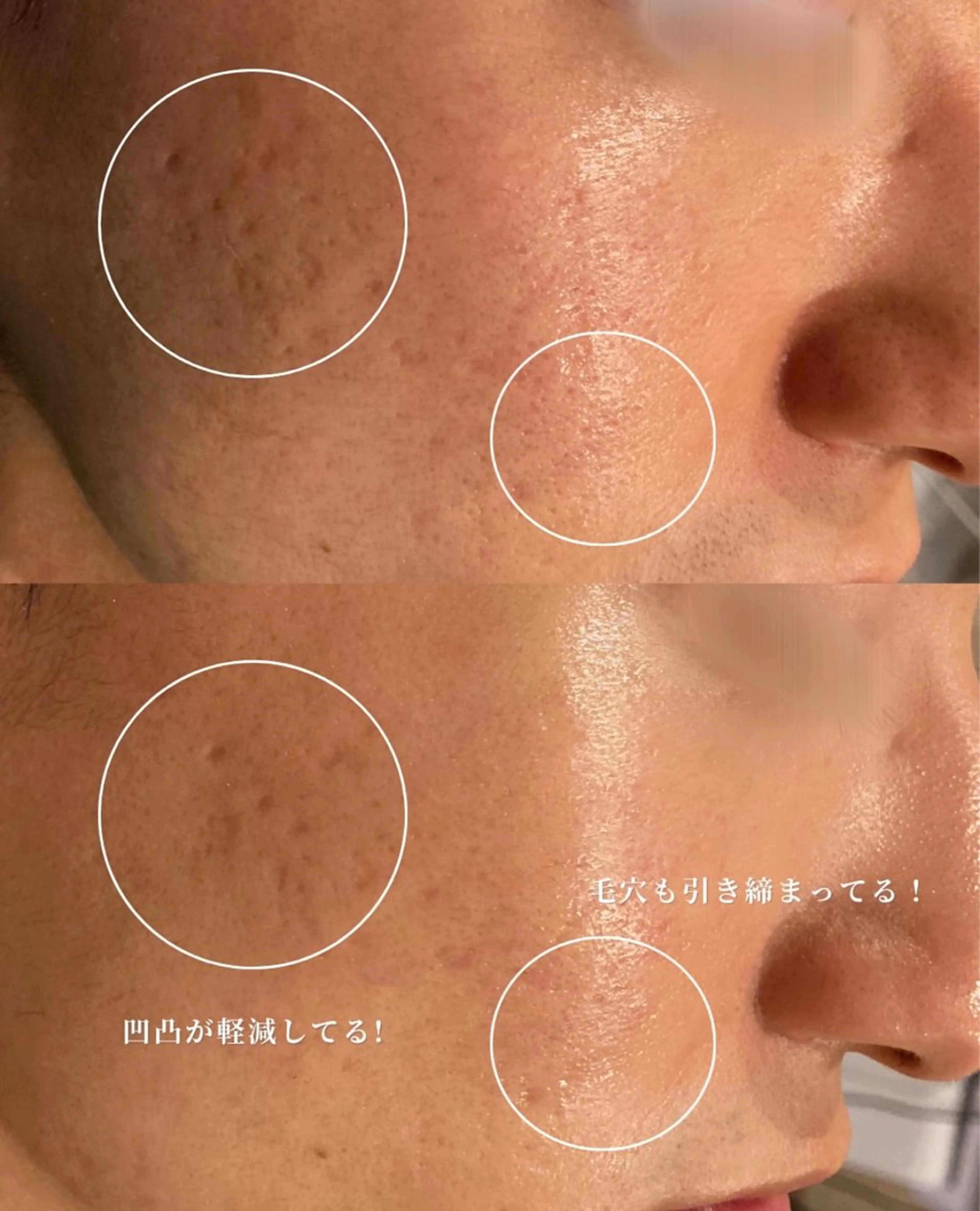 Nsが施術するサロン ナスサロ /Yuriのエステ・リラクイメージ