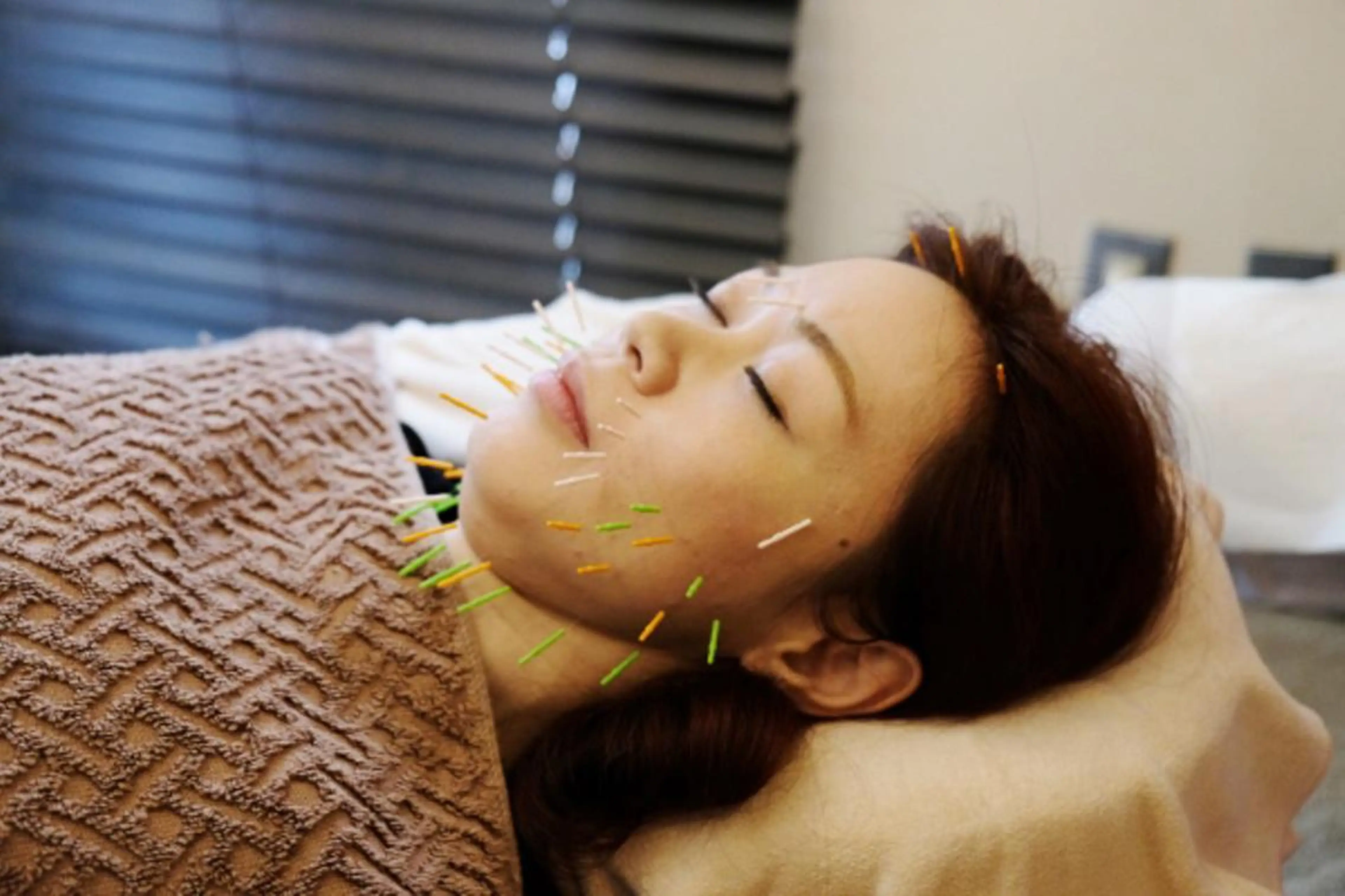 Acupuncture salon LINOA リノア鍼灸院所属・ヘッドスパ鍼/小顔鍼 EMS LINOAのエステ・リラクイメージ