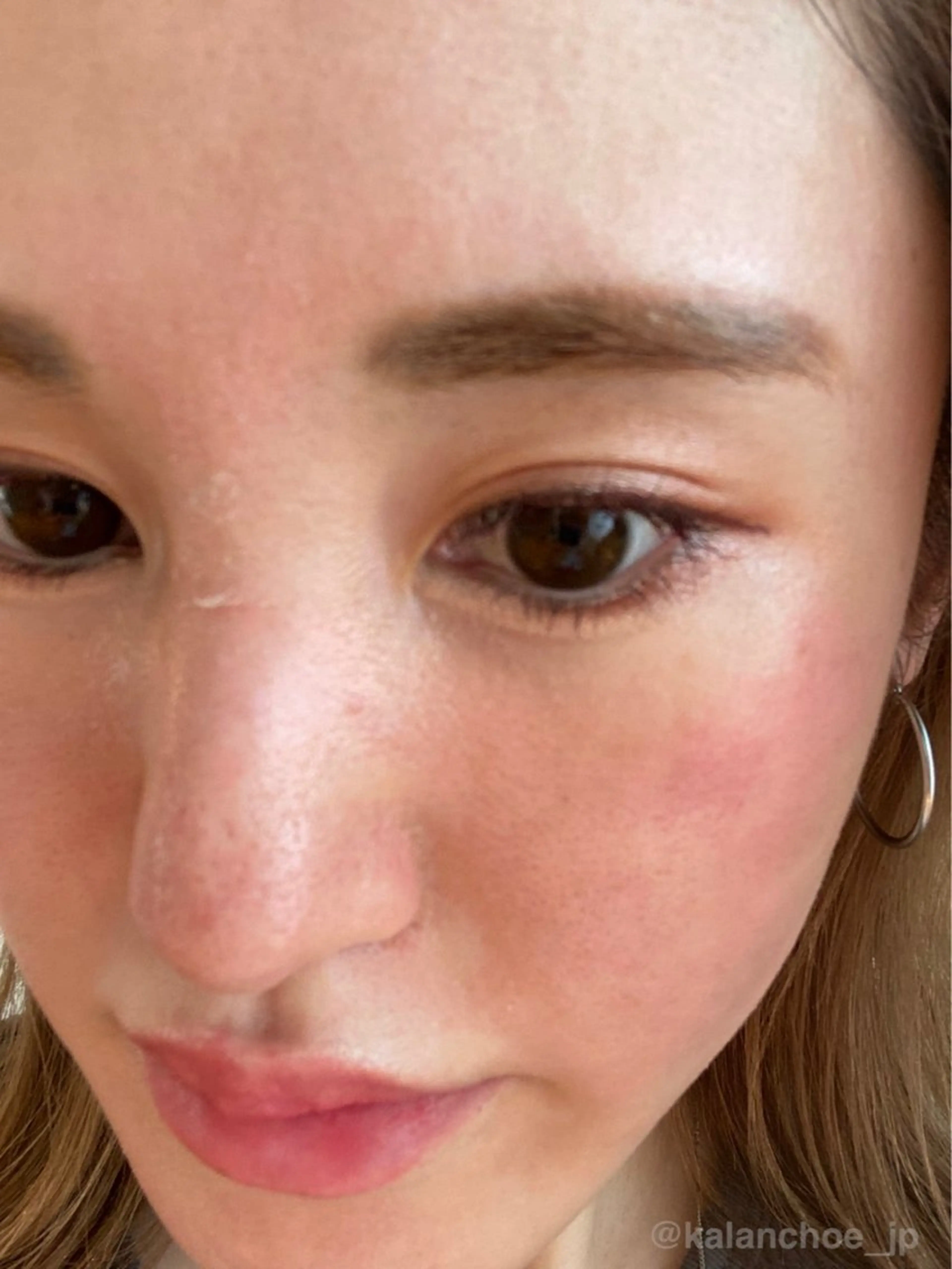 肌質改善 KALANCHOEのエステ・リラクイメージ