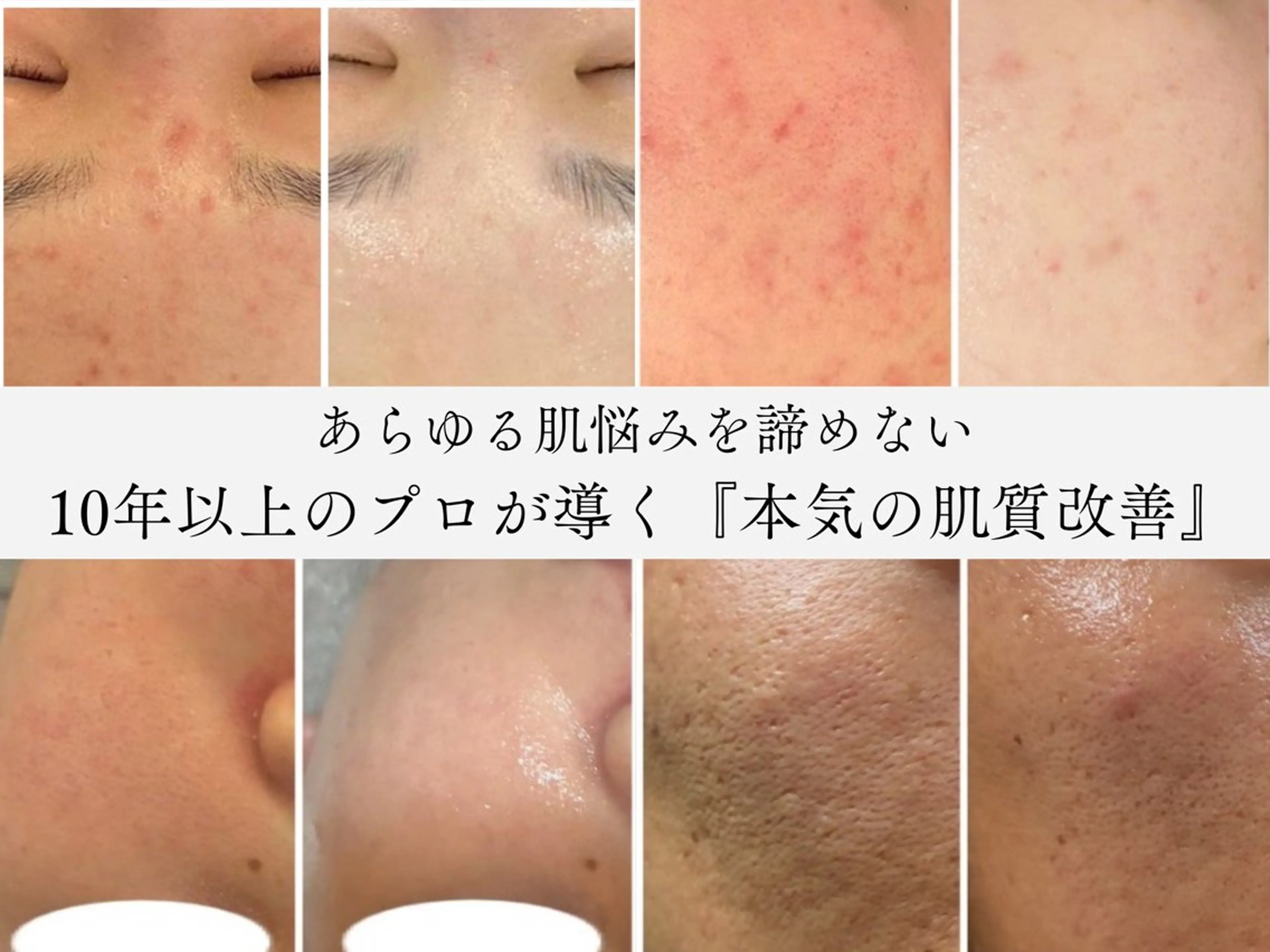 肌質改善サロン Noaのエステ・リラクイメージ