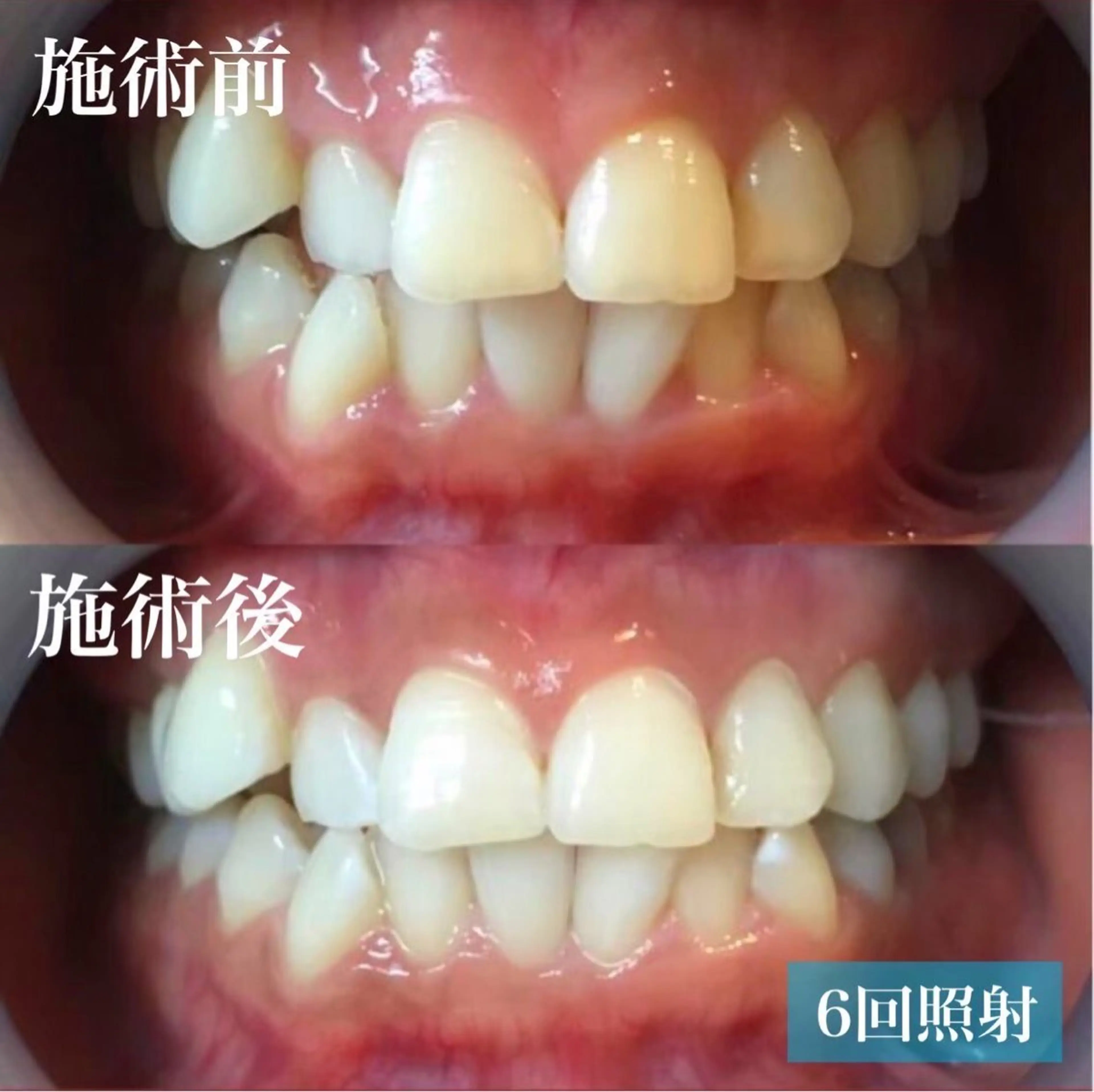 エステ リラク LBSホワイトニング上野店所属・LBSホワイトニング 🌐 上野店公式のエステ・リラクイメージ