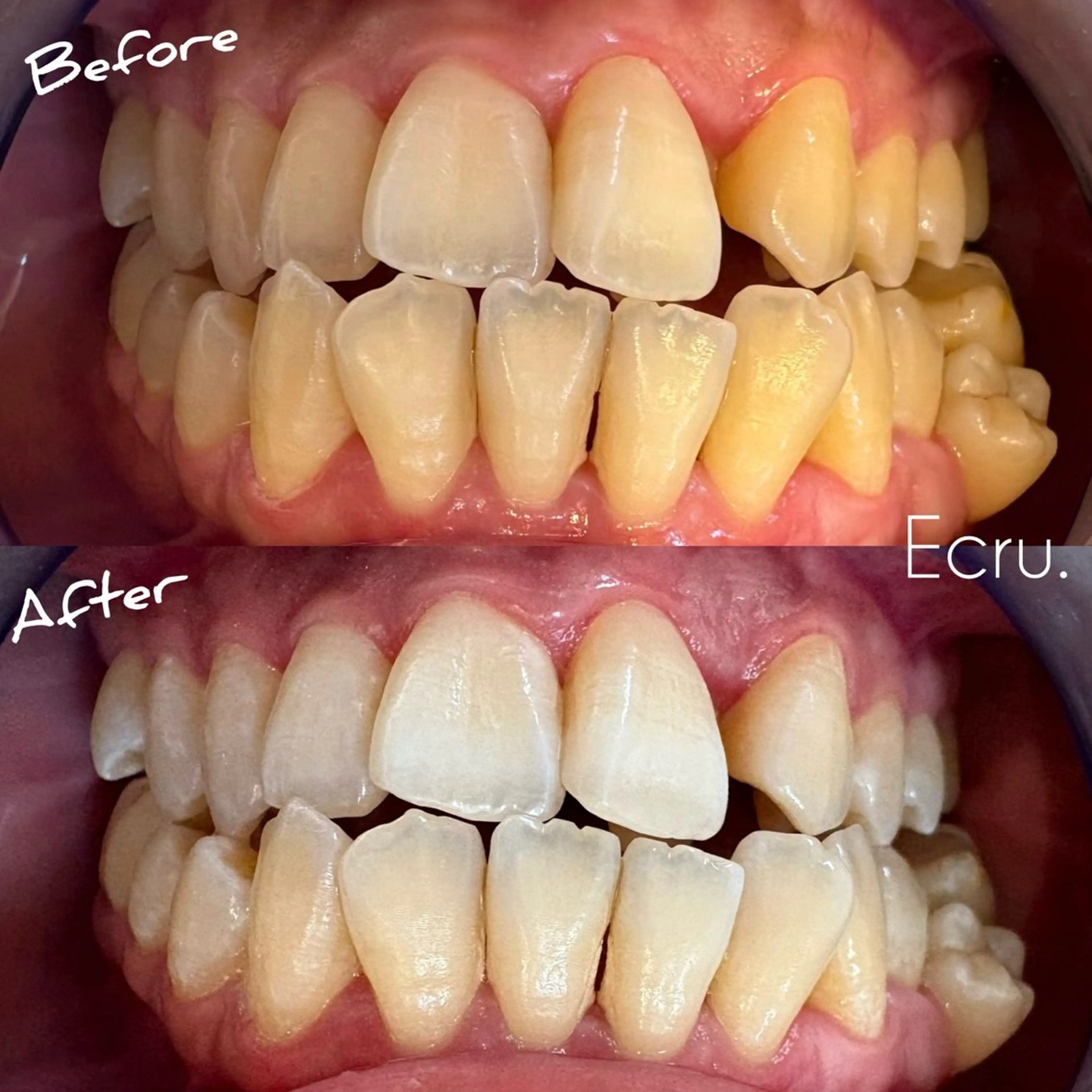 メンズ キッズ エステ ホワイトニングサロン Ecru所属・ホワイトニングサロン Ecru エクリュのその他イメージ