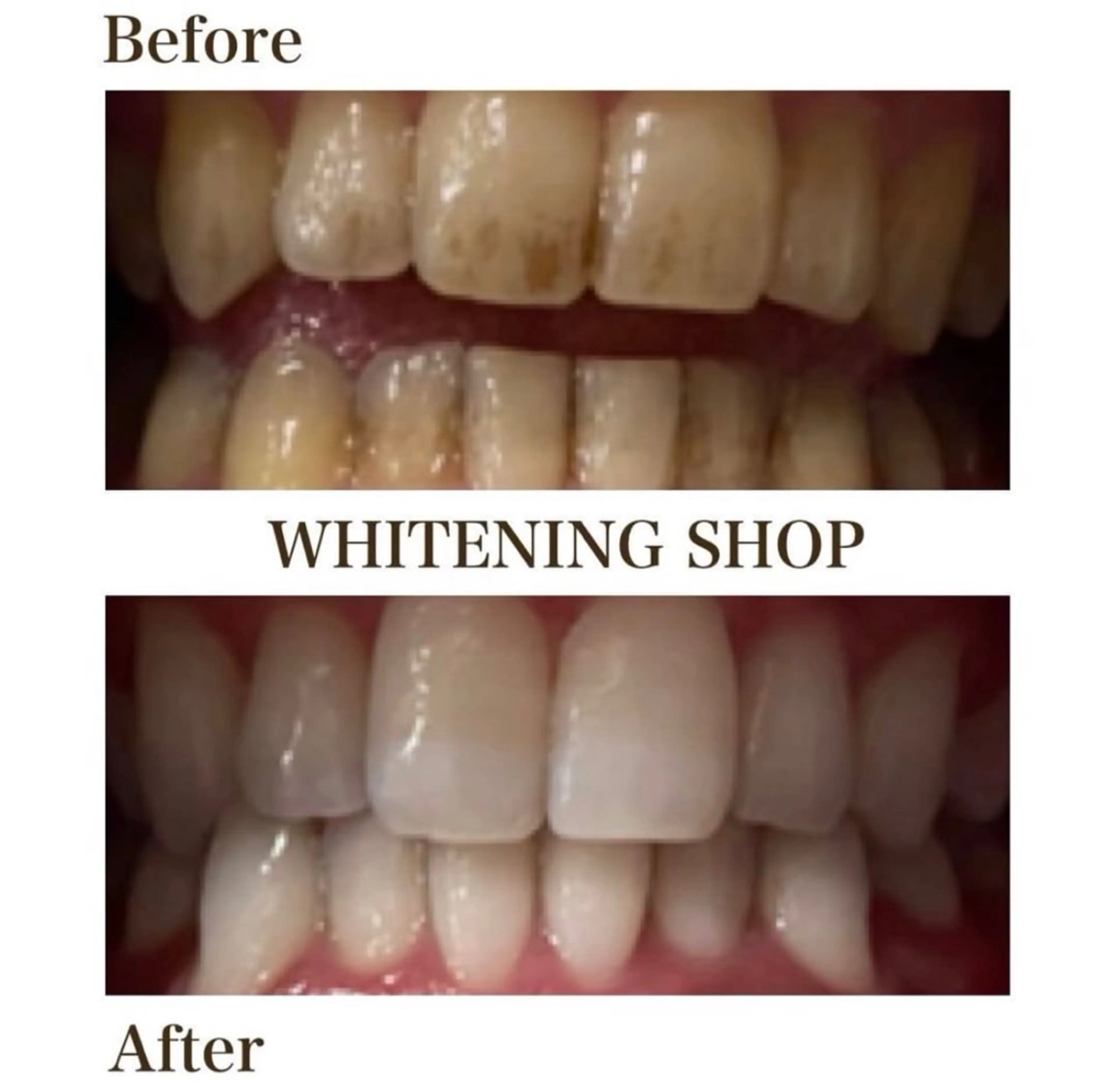 ホワイトニング ショップ伊丹店のその他イメージ