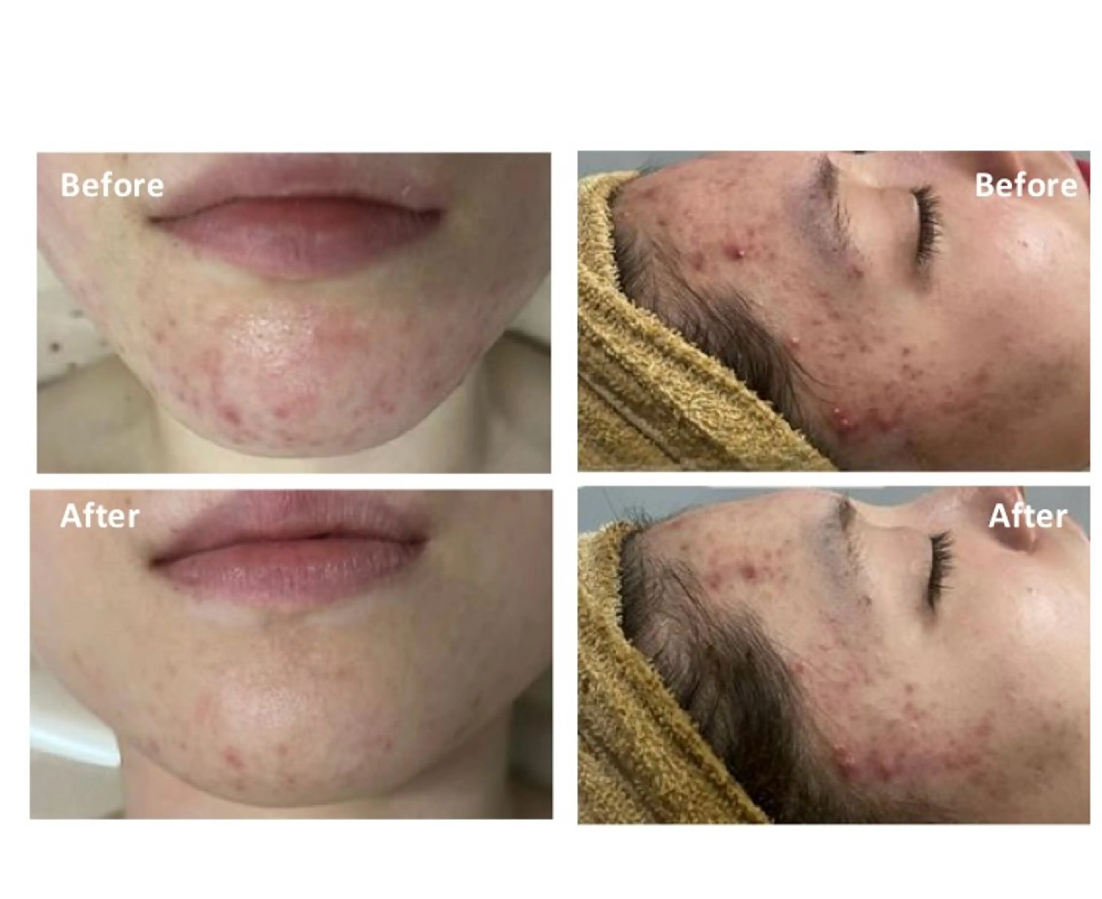 エステ ririサロン Ayaのエステ・リラクイメージ