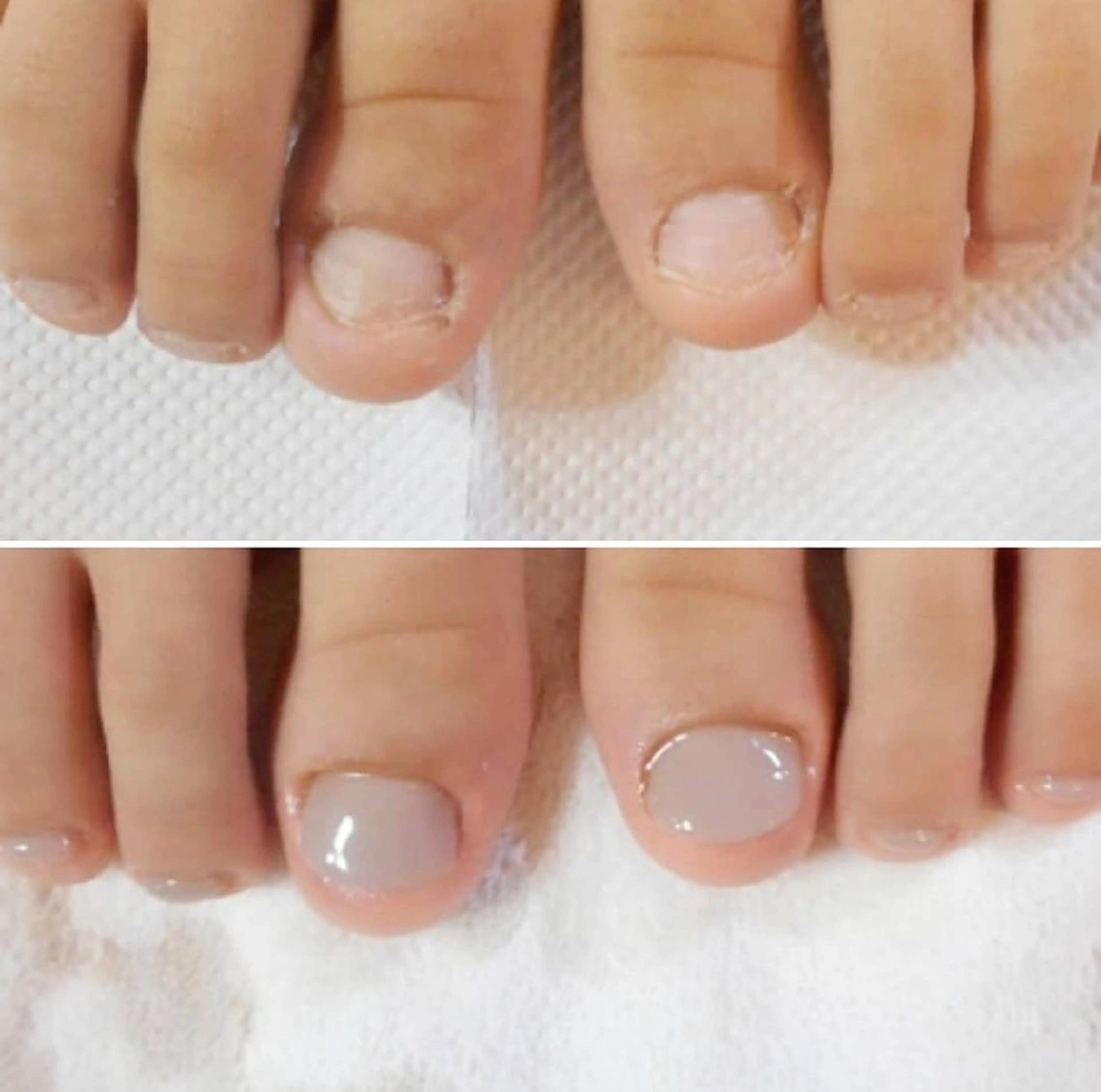 ネイル フットネイル ネイルサロンアリューム所属・ネイルサロン アリュームのネイルデザイン