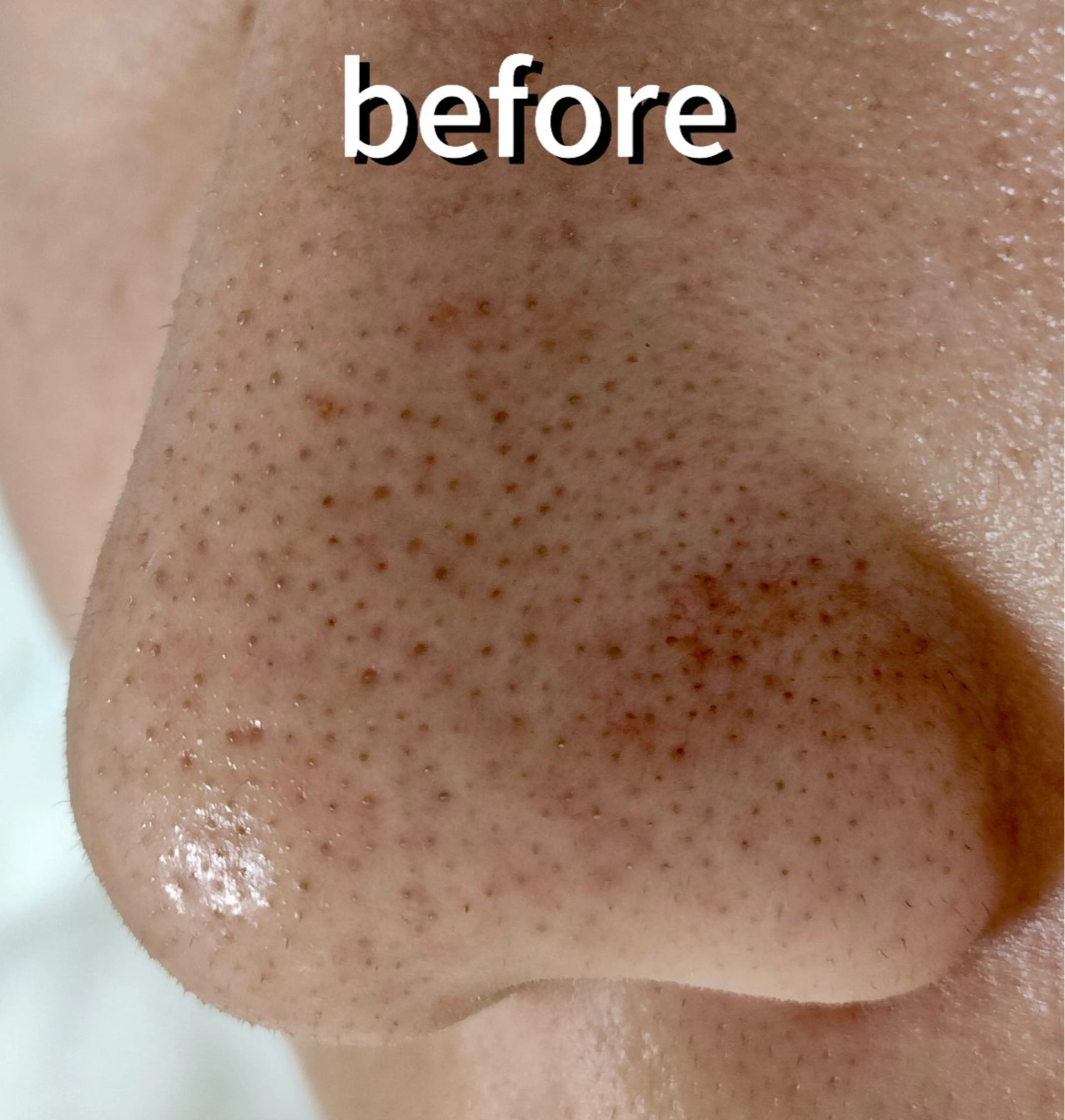 その他 麻布十番エステサロン WhiteAzabuのエステ・リラクイメージ