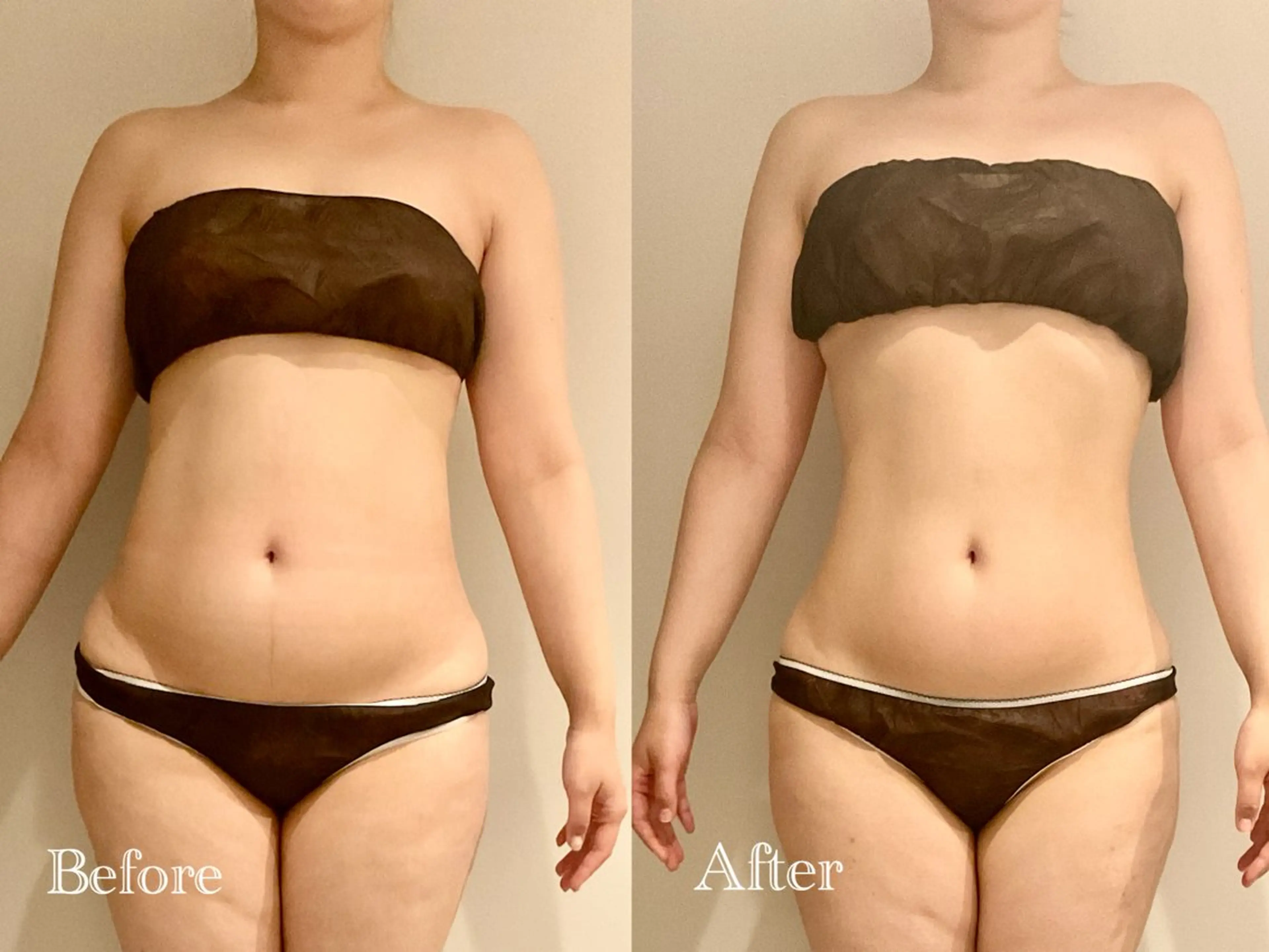 ※スタッフ🈯️⏰人気No.1メニュー✨🉐【短期間でサイズダウン🔥】全身痩せ90分コースの写真