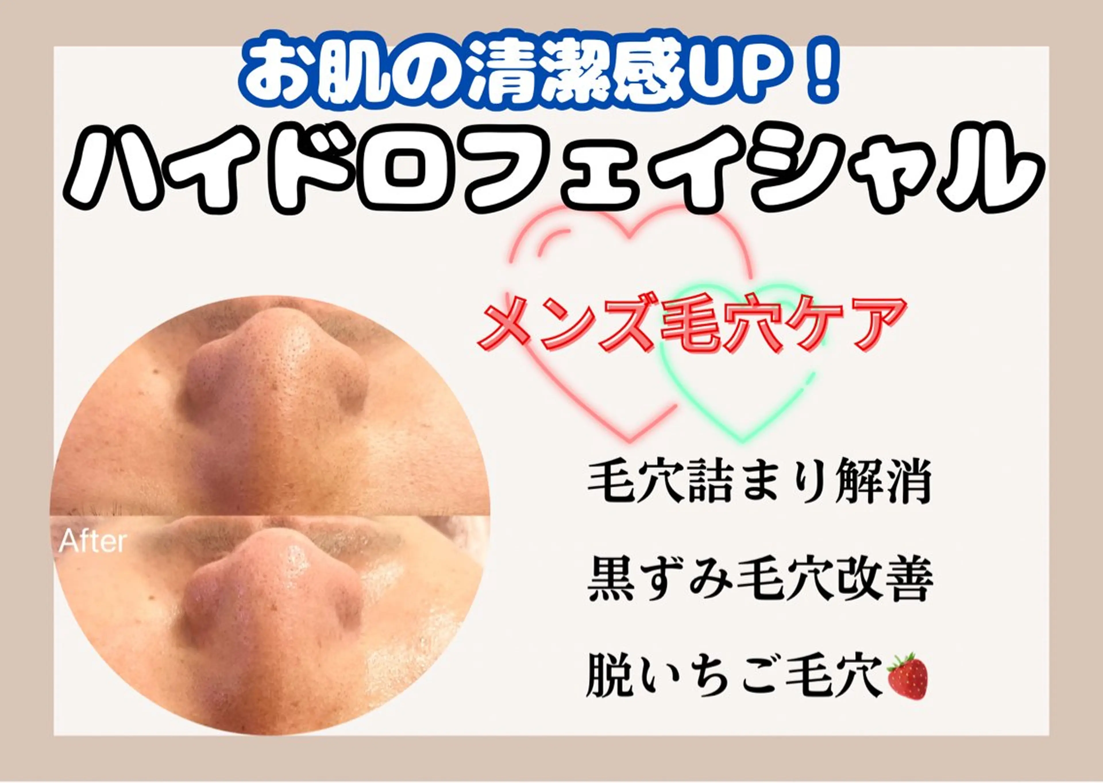 【いちご毛穴改善で清潔感UP】メンズ水素毛穴洗浄の写真