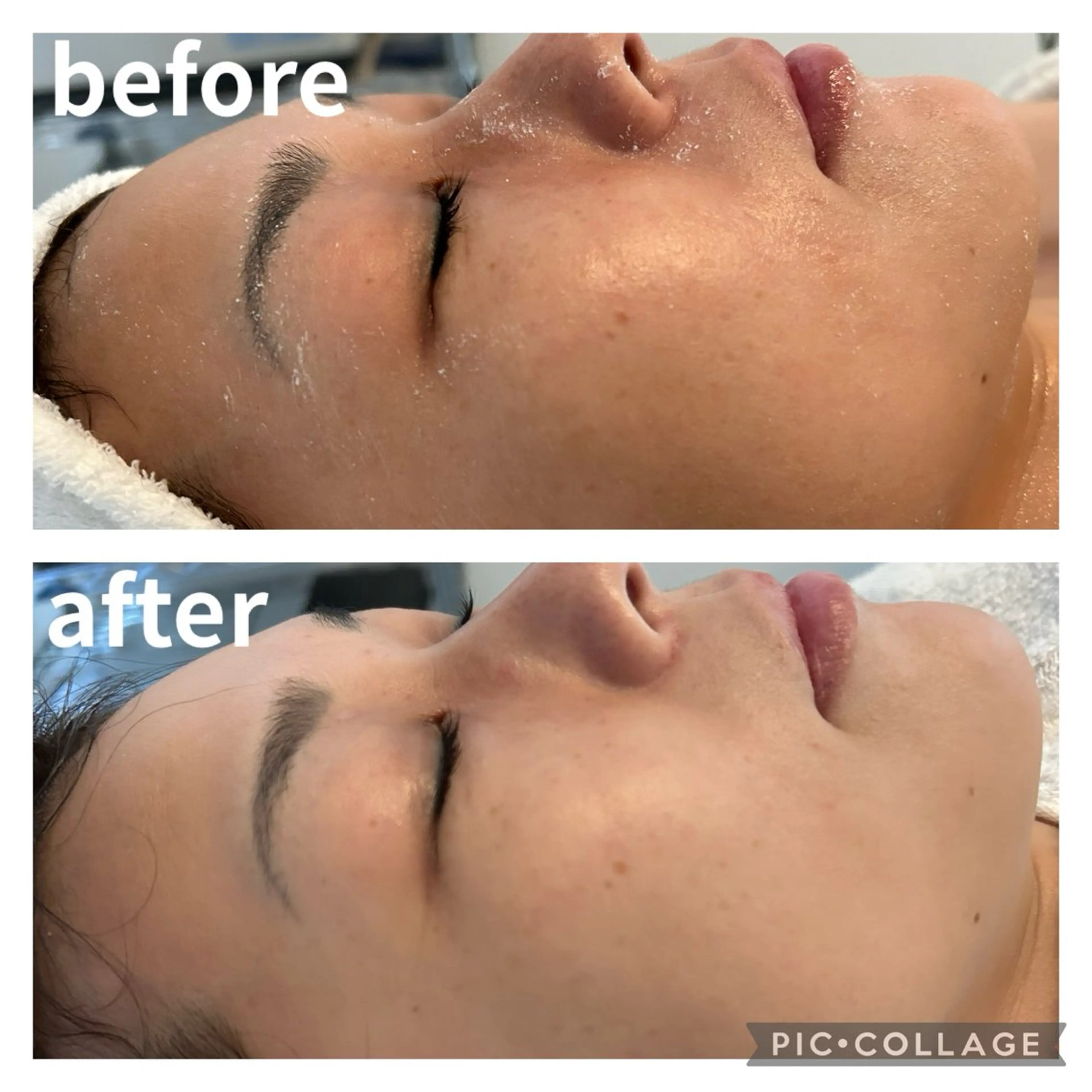 徹底美白♡2トーンUP目指します‼︎の写真