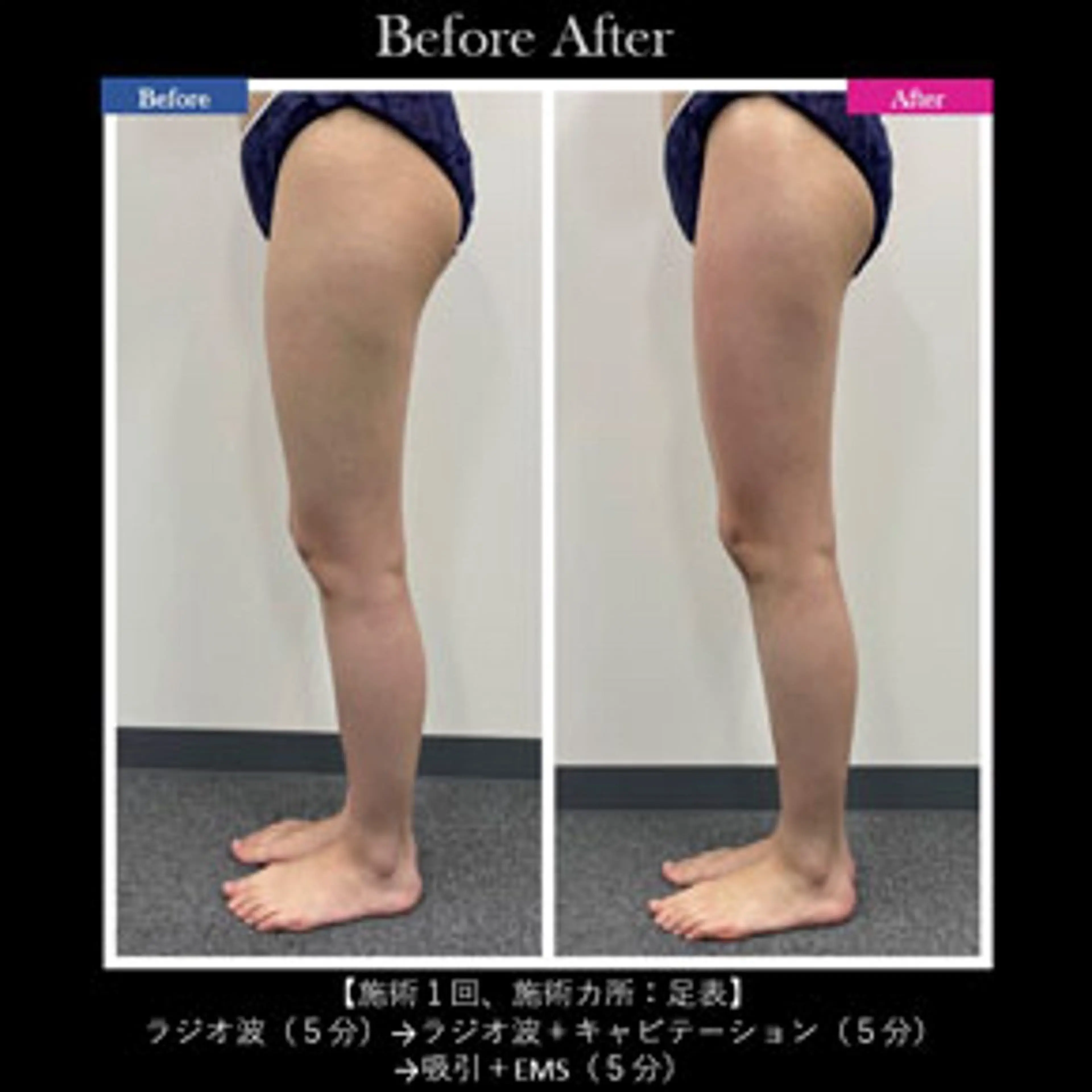 伊藤 正美のマツエク・マツパデザイン