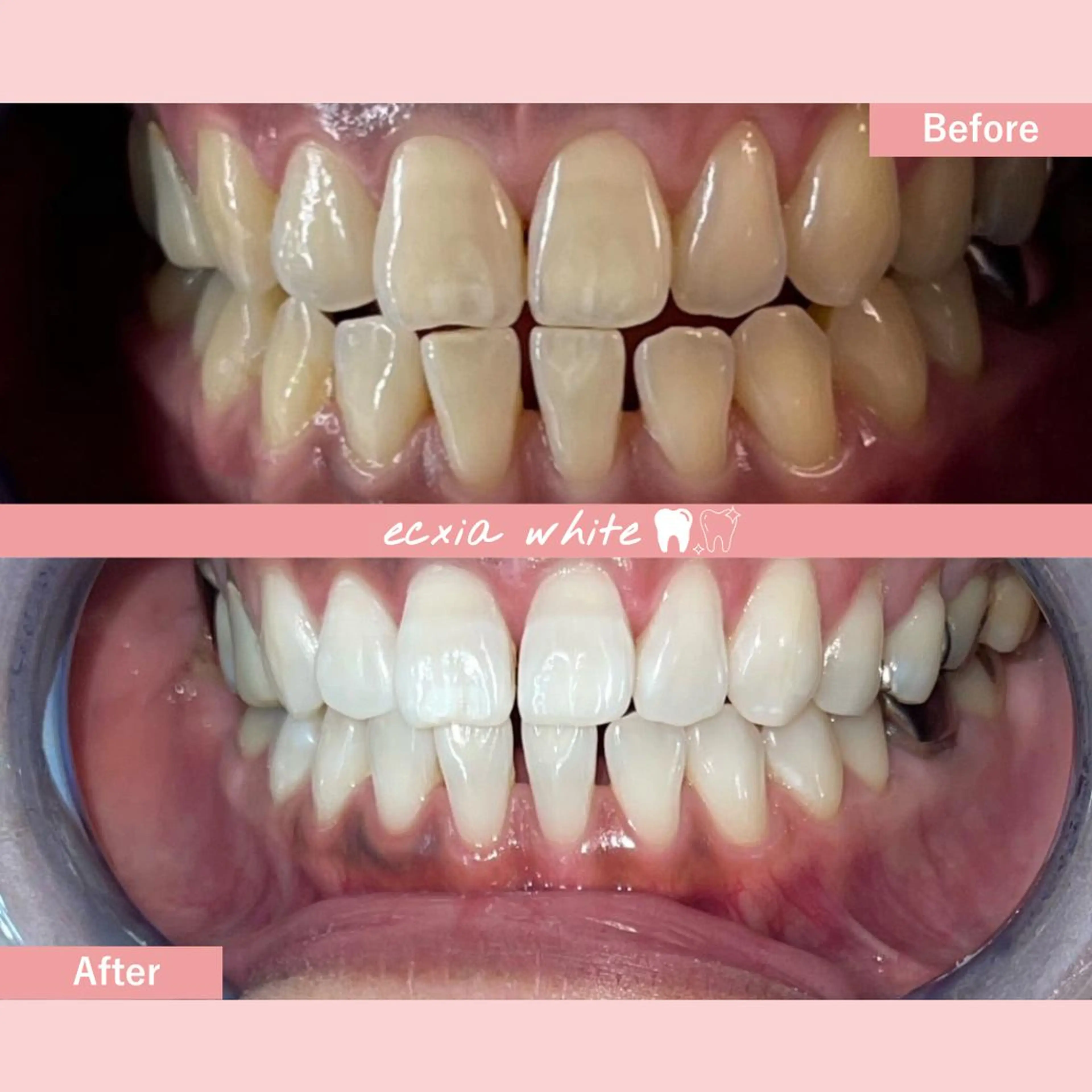 セルフホワイトニング エクシア中島公園店のその他イメージ