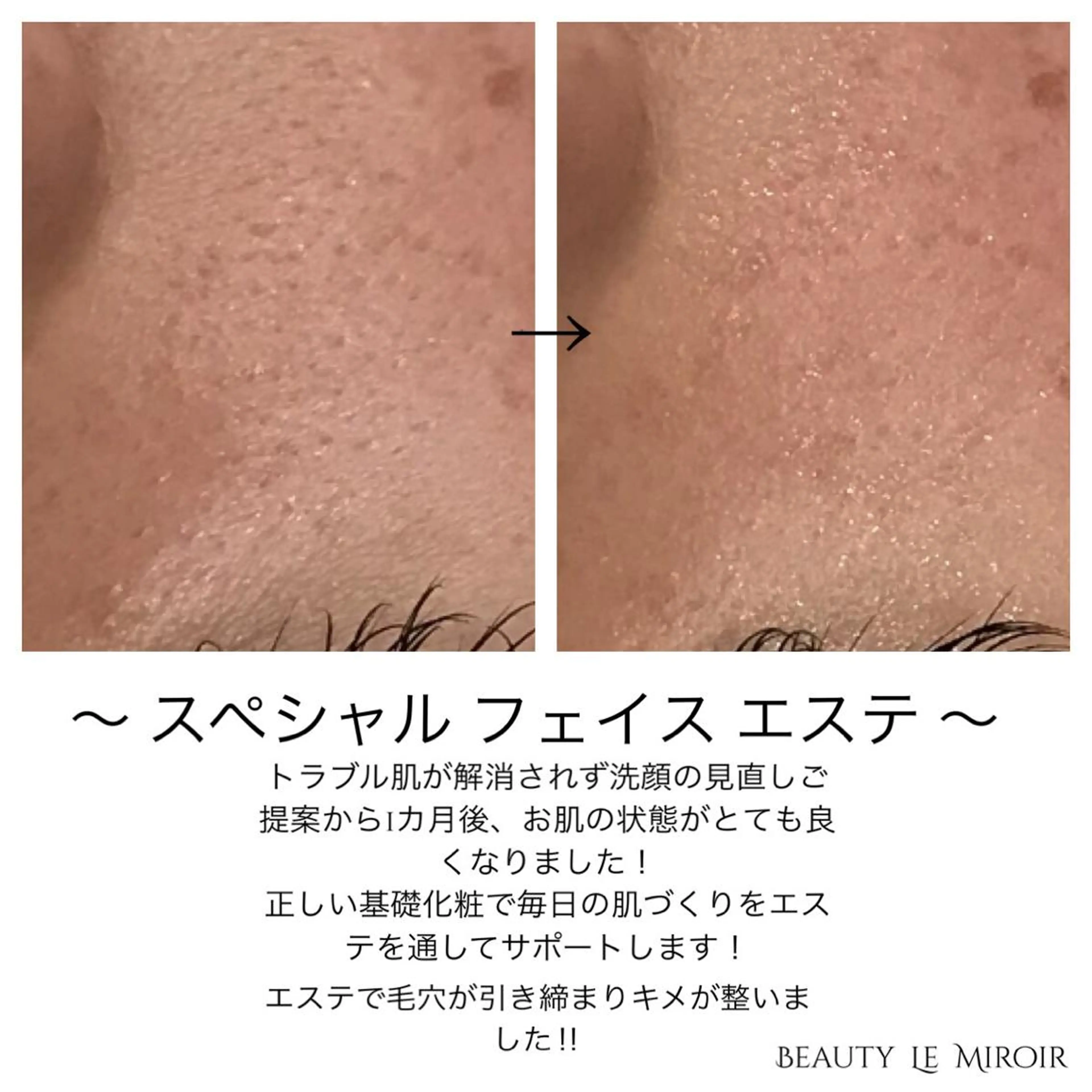 ビューティー ミロワールのエステ・リラクイメージ