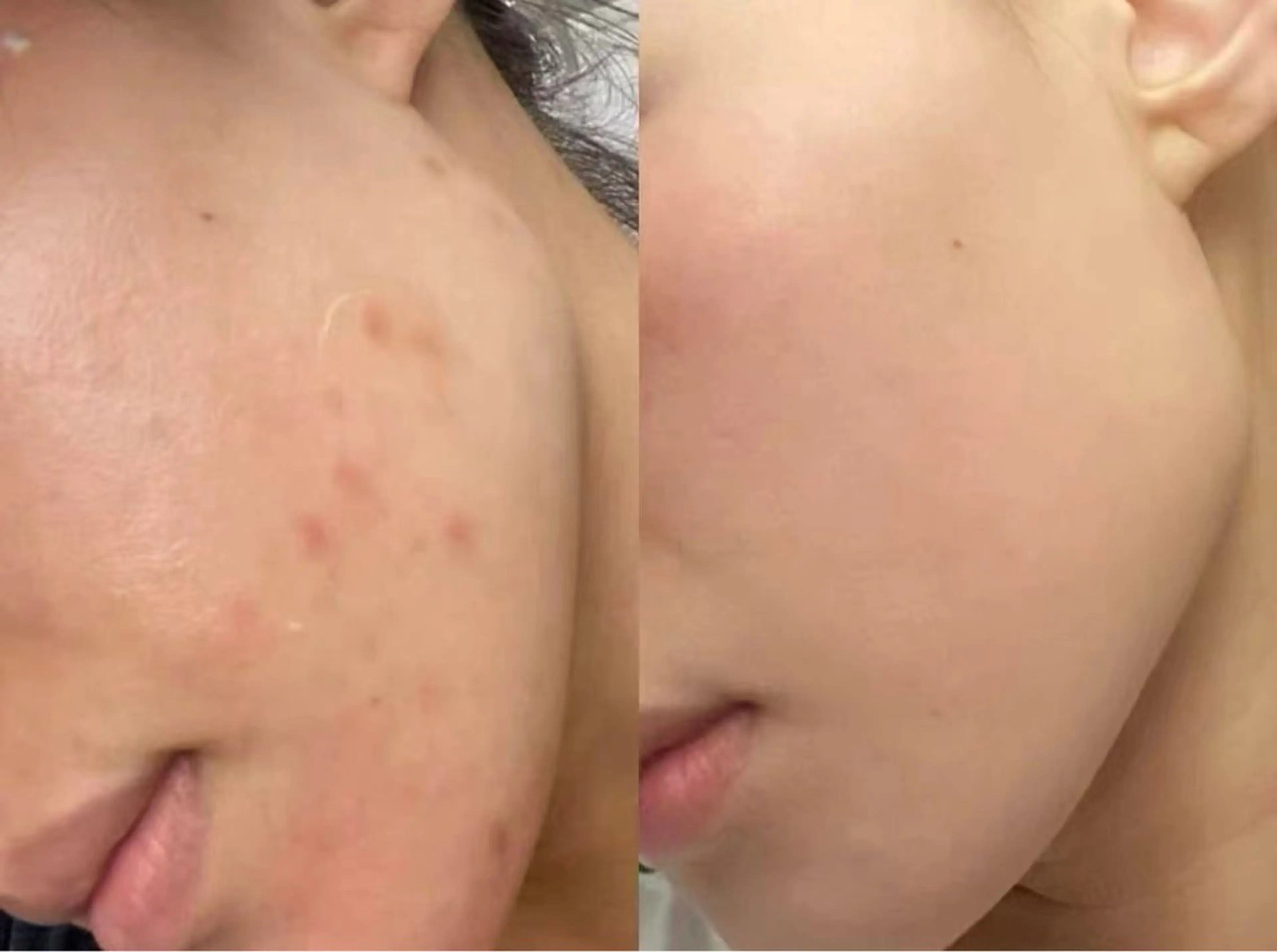 肌管理専門店 Shandeelのエステ・リラクイメージ