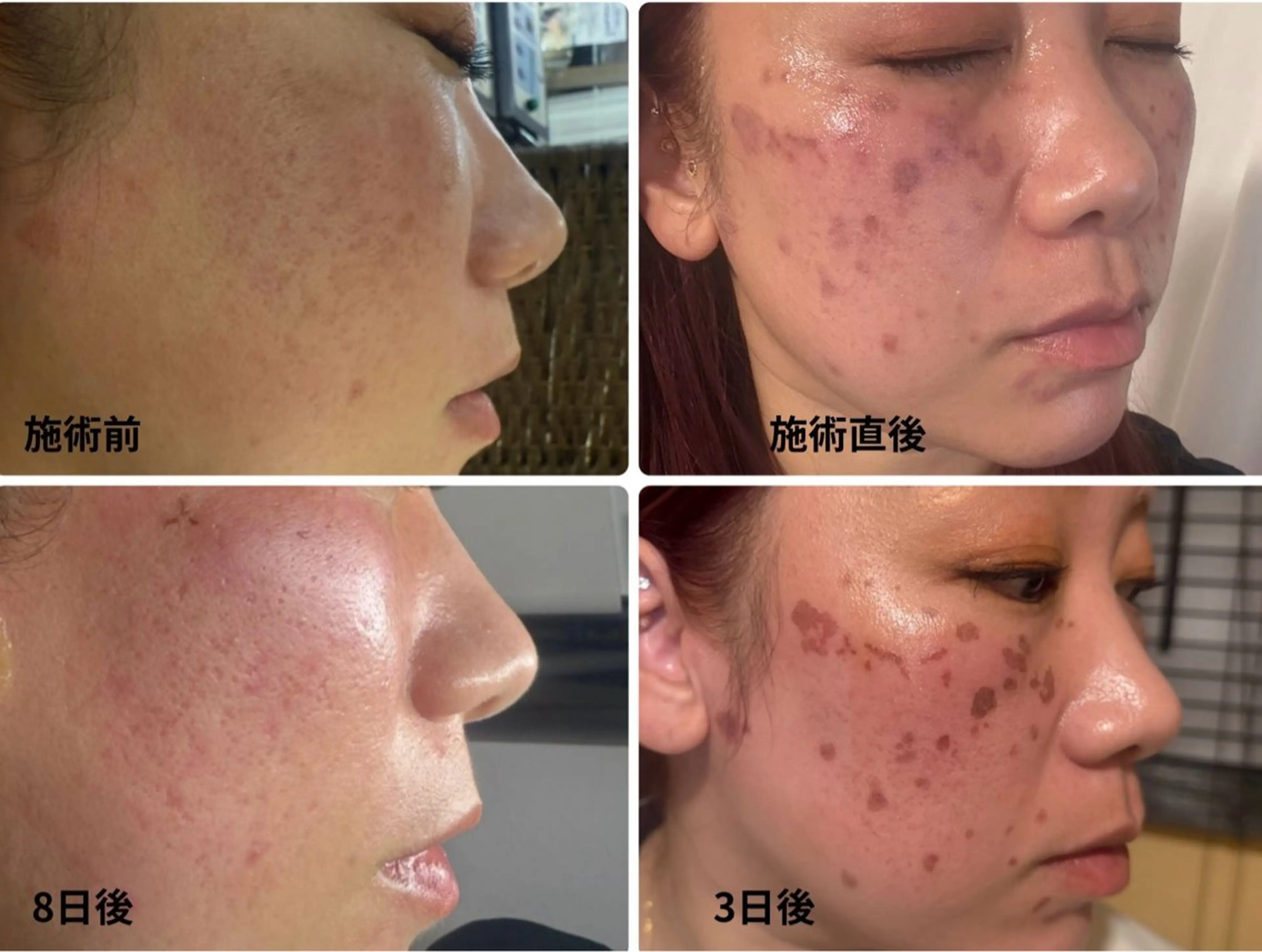 エステ healthy& beautyDEWAのエステ・リラクイメージ