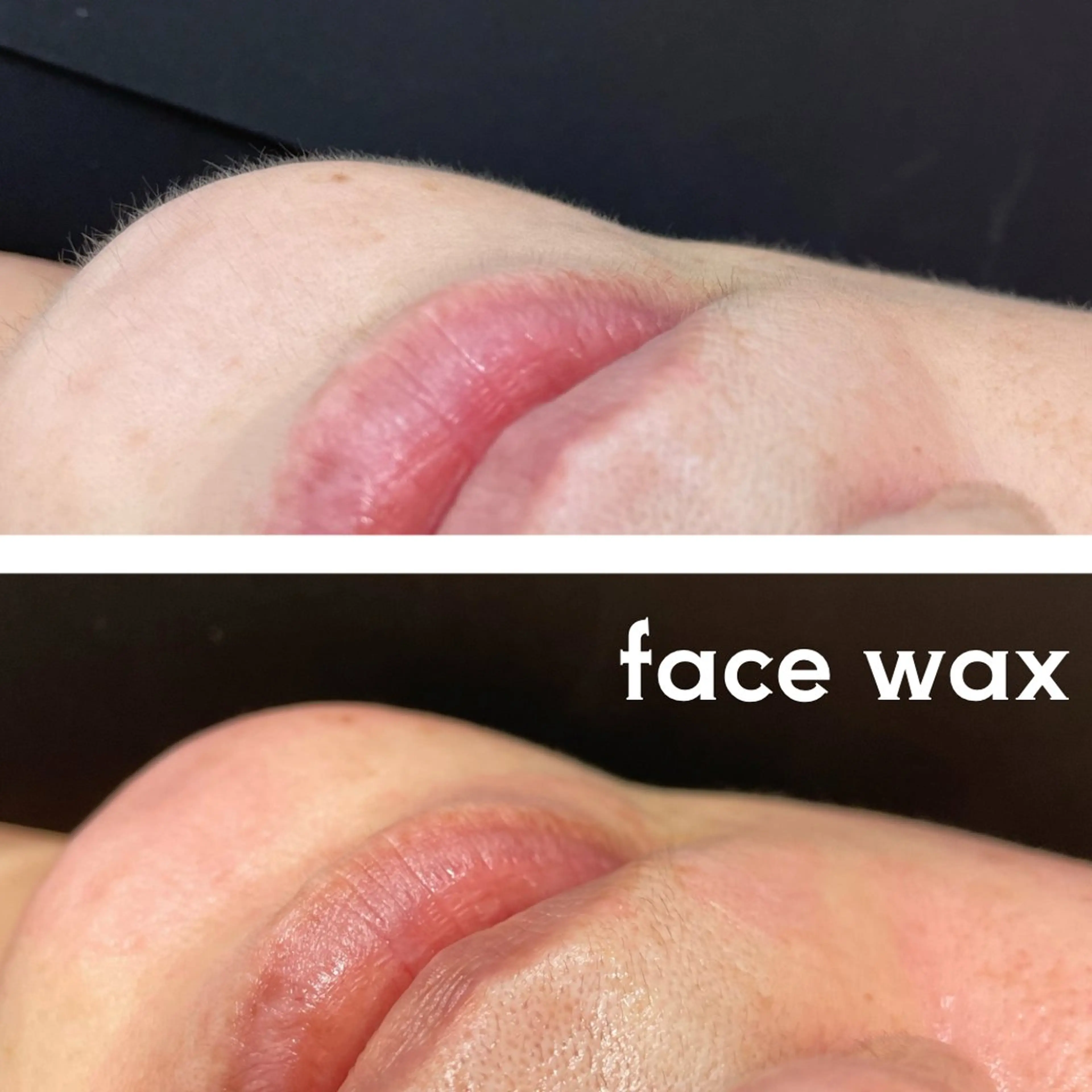 フェイスワックス＋ハイドロ炭酸パック🫧の写真