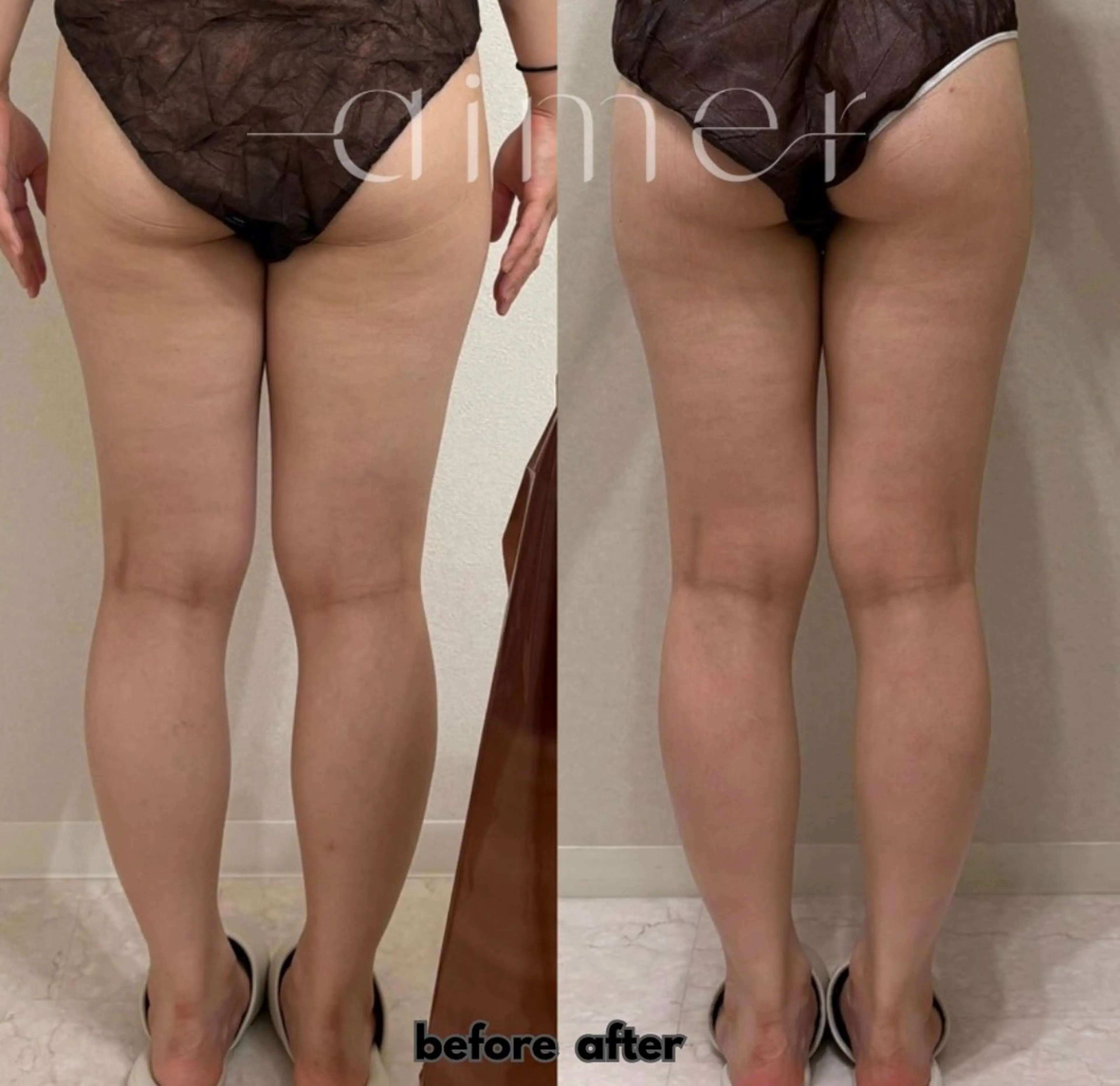 エステ リラク aimer 佐々木のエステ・リラクイメージ