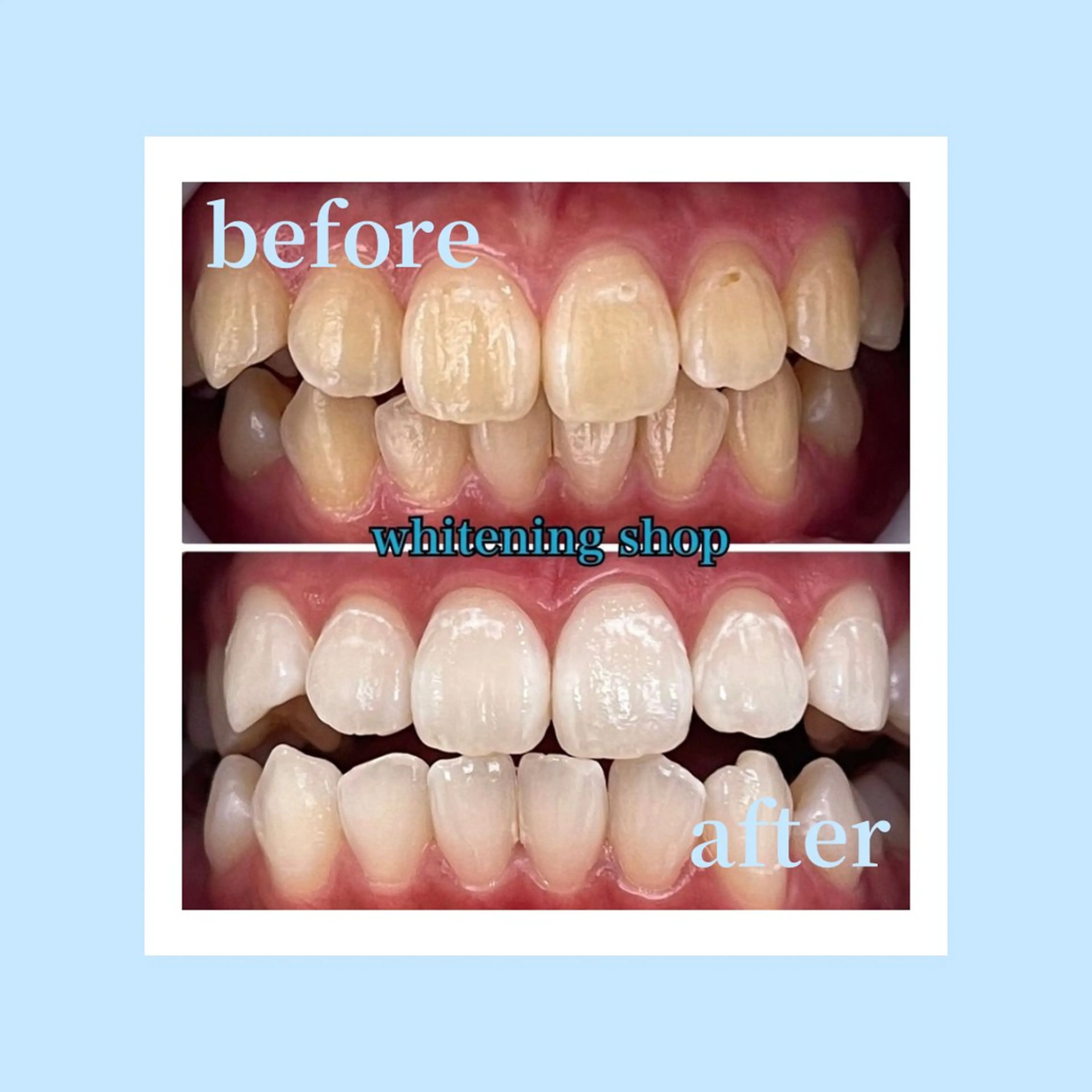 ホワイトニング ショップ光明池店のエステ・リラクイメージ