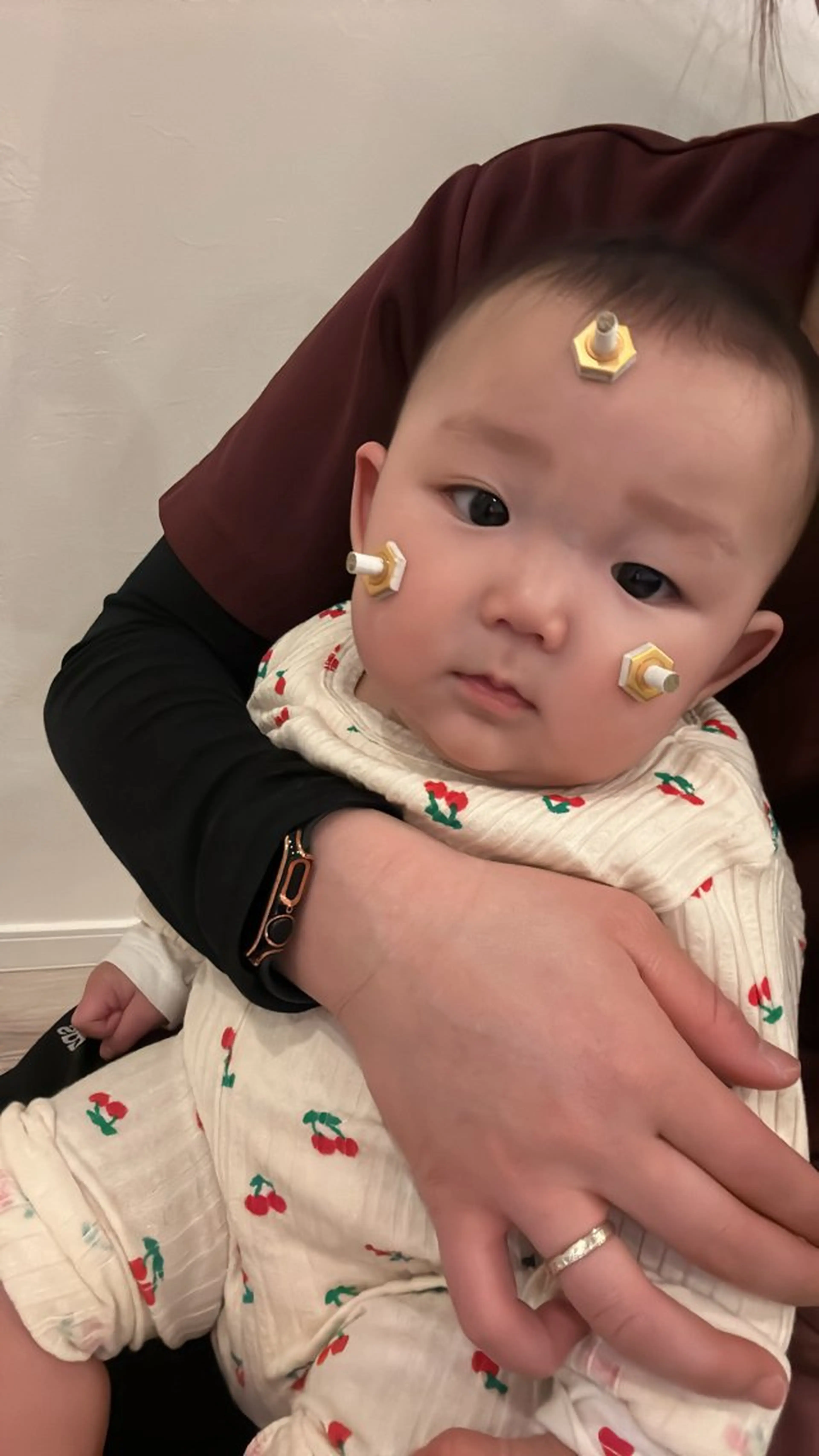 エステ リラク 肌質改善×美容鍼 ゆいのエステ・リラクイメージ