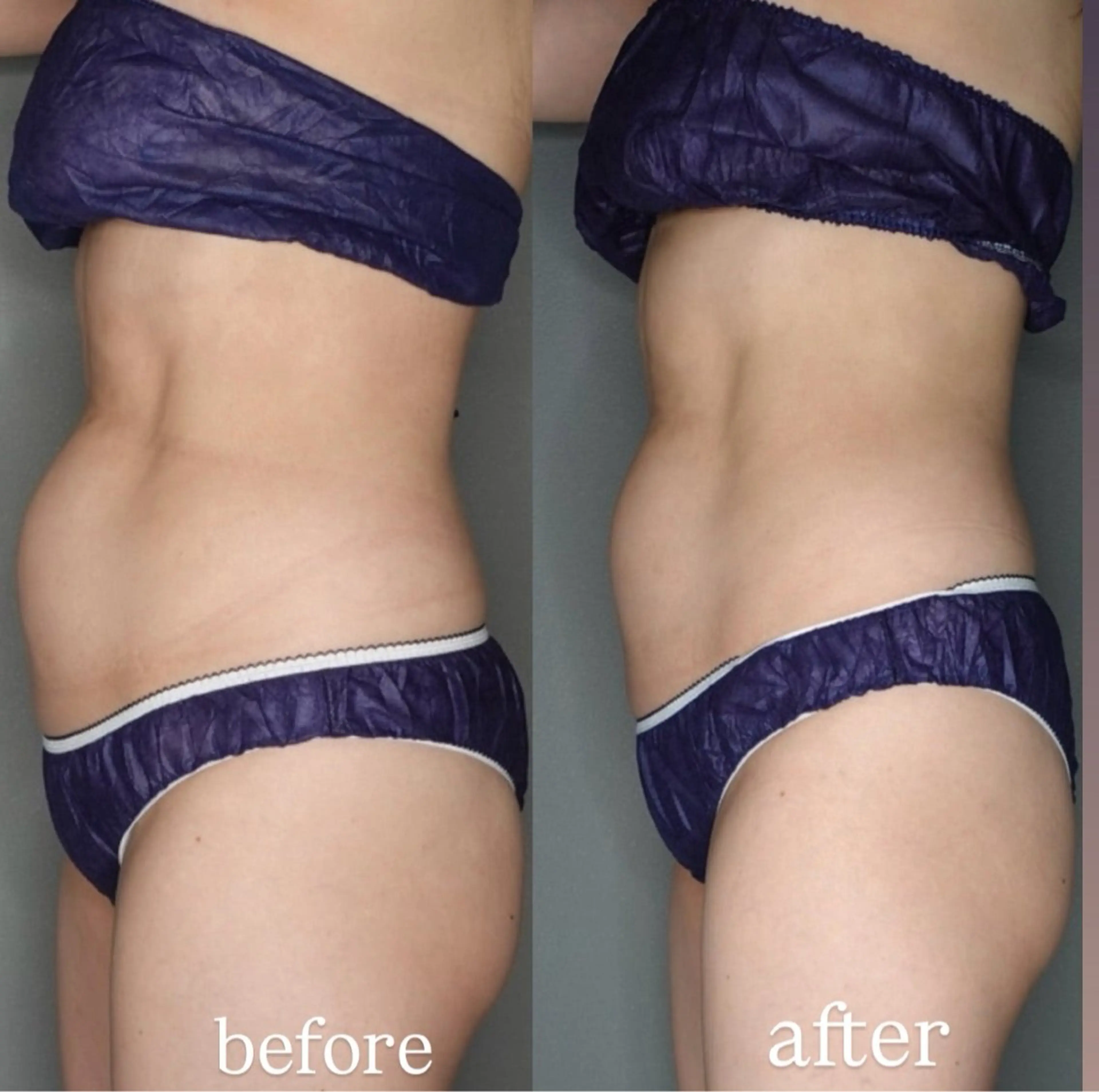 トータルボディケア chouchouのエステ・リラクイメージ