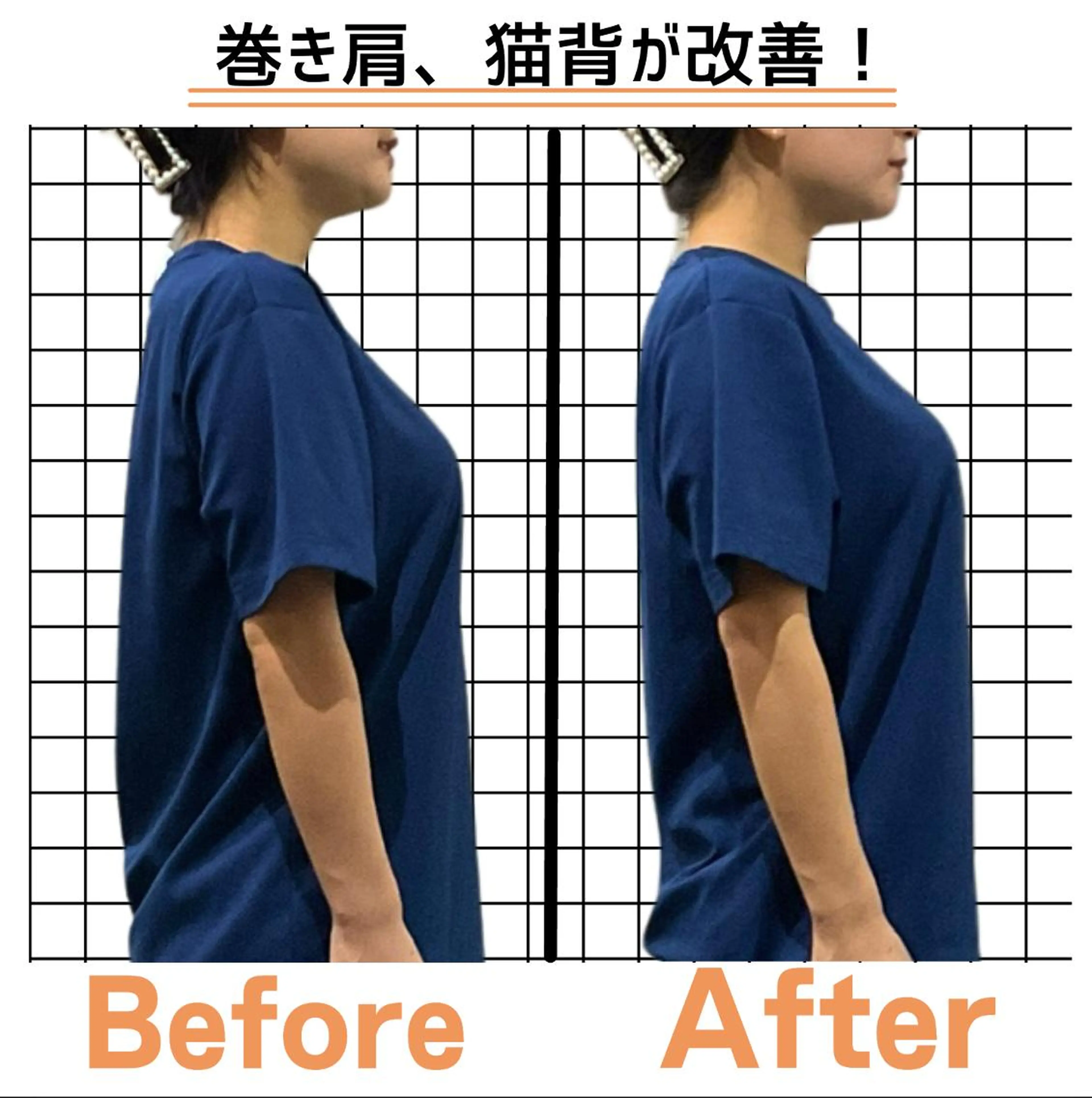 【反り腰/猫背】姿勢美人コース60分 初回体験 ¥11000→¥3000の写真