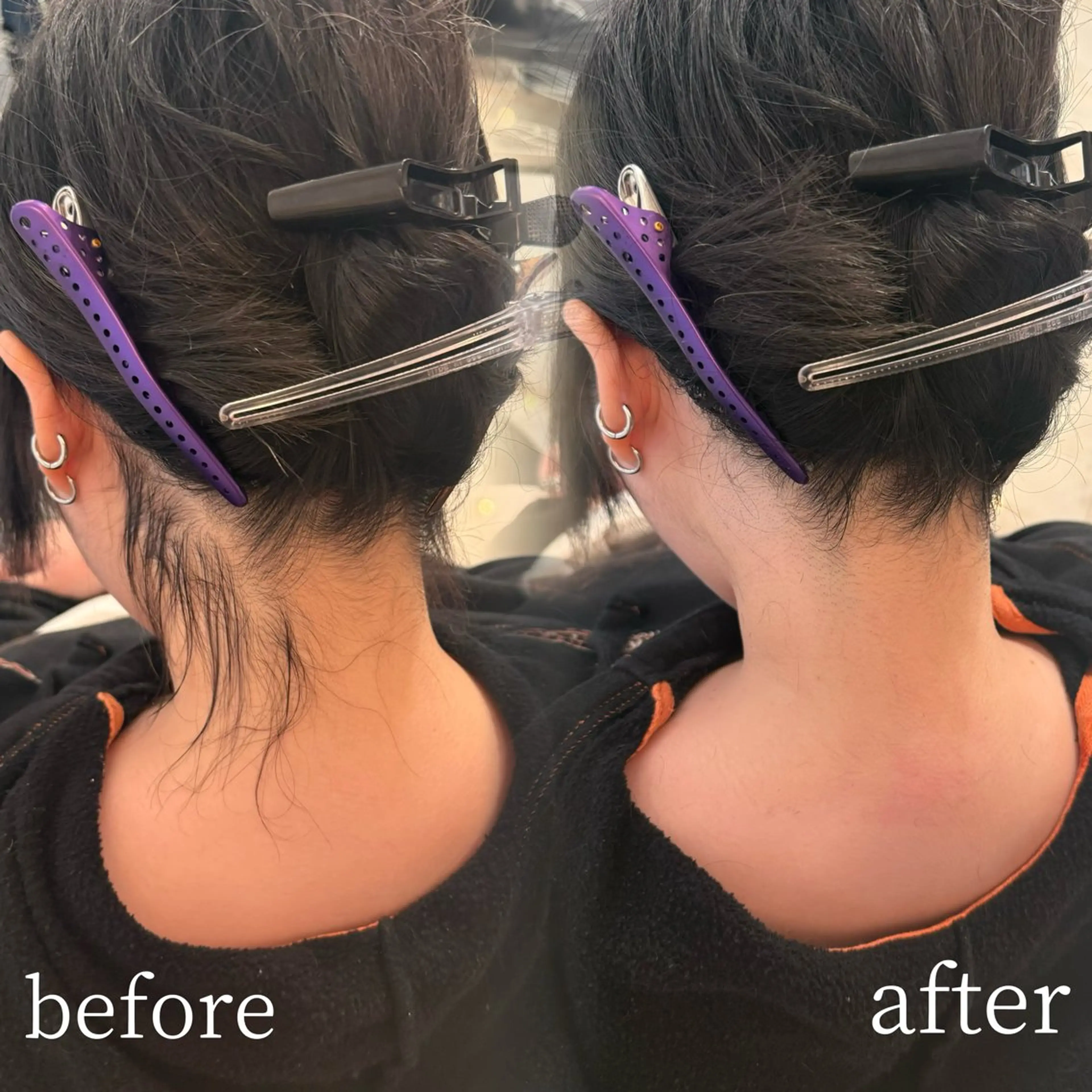 脱毛 HARUNA/原宿/ デザイン/カットのヘアスタイル