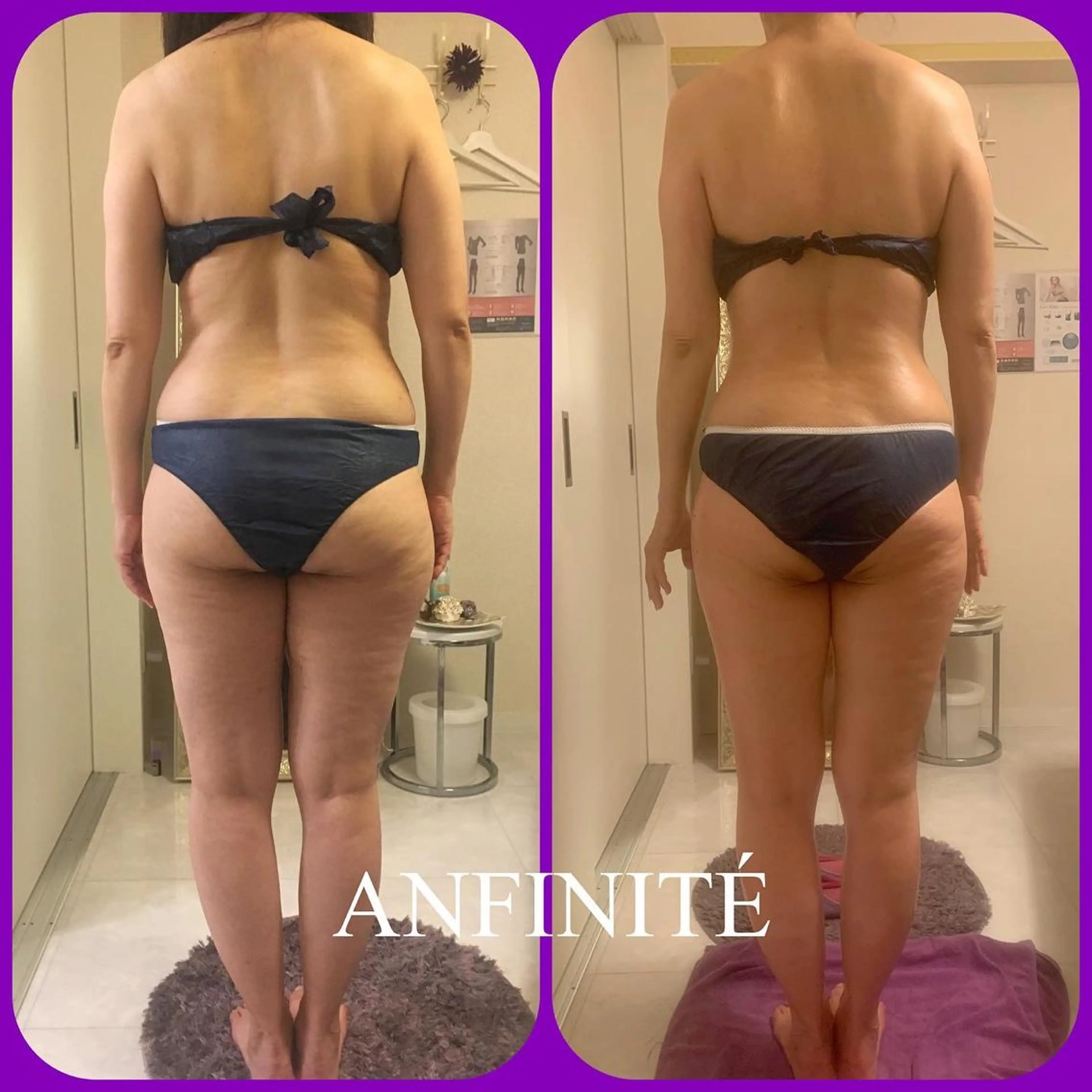 エステ リラク ANFINITÉ アンフィニテのエステ・リラクイメージ