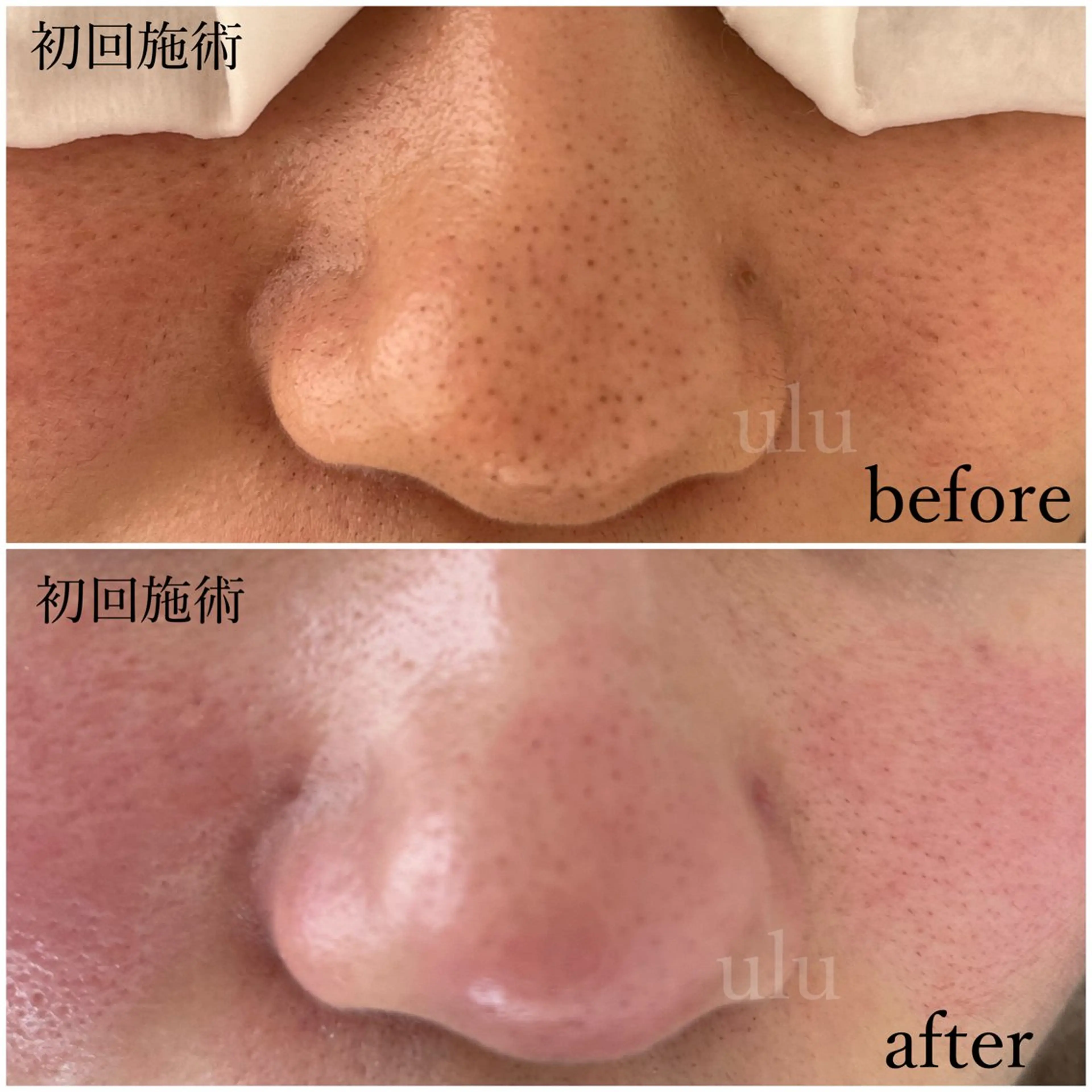 beauty salon uluの眉毛・アイブロウイメージ