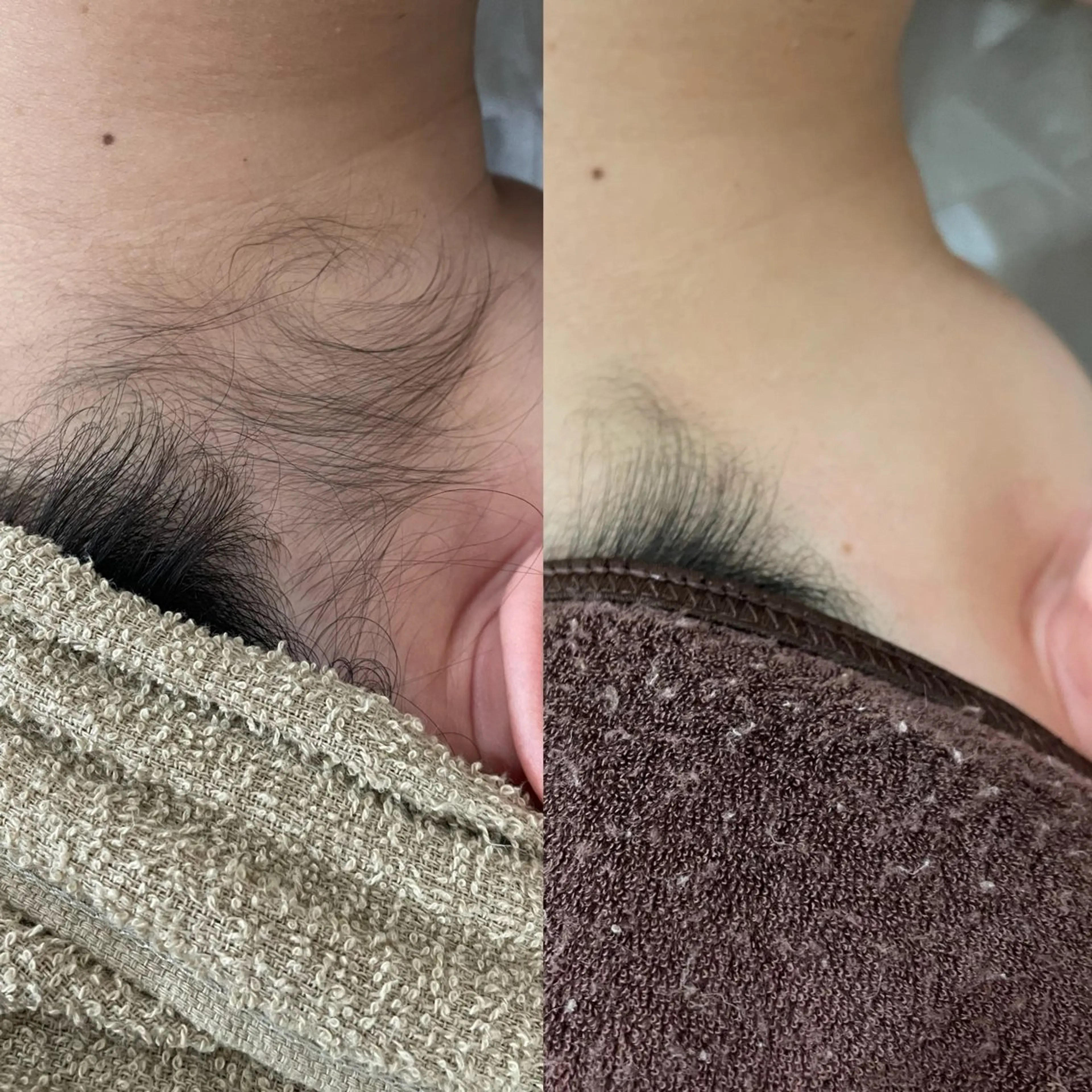 後ろ姿美人🎀うなじ脱毛の写真