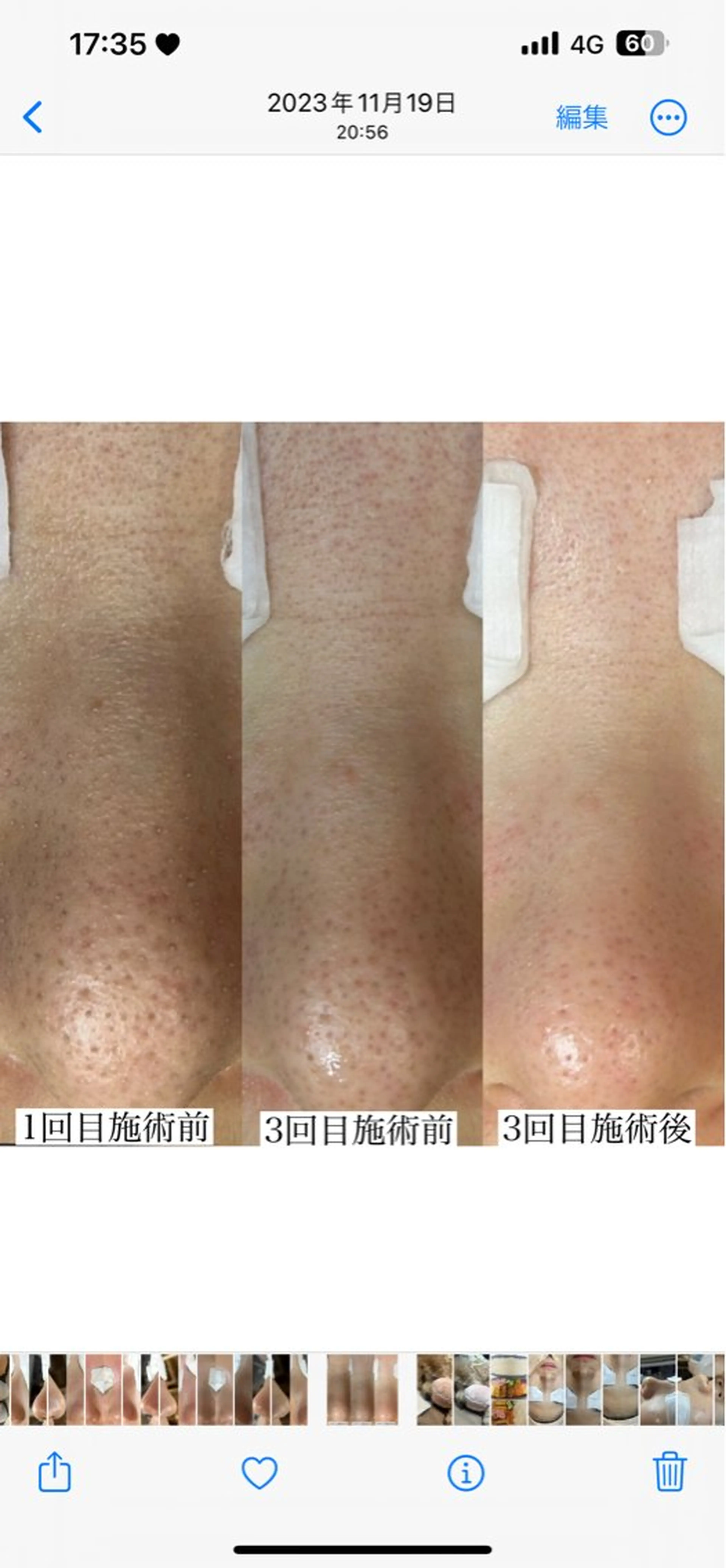 毛穴専門店 マカナアロハのエステ・リラクイメージ