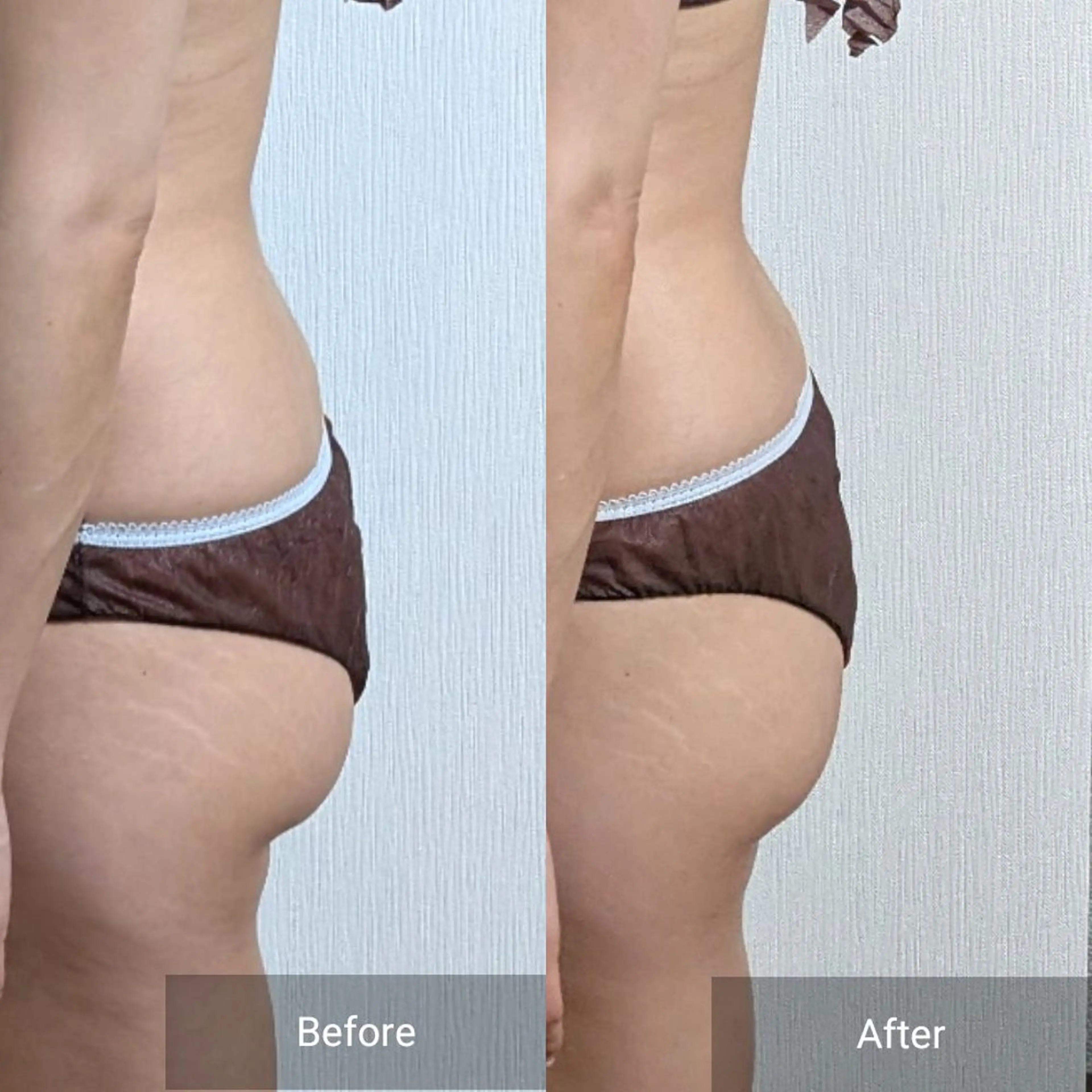 エステ nail RiRi アトレナチュラのエステ・リラクイメージ