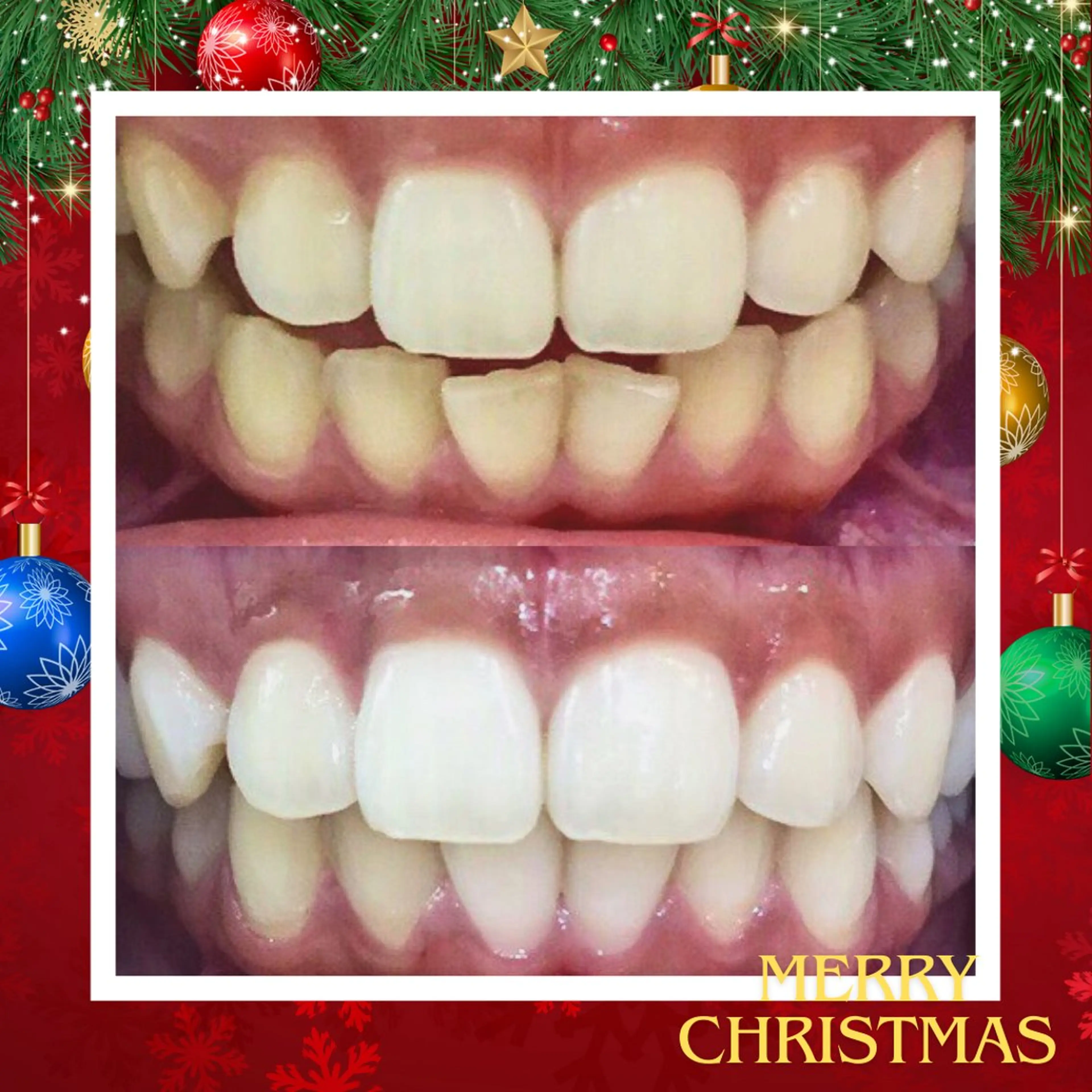 エステ リラク LBSホワイトニング上野店所属・LBSホワイトニング 🌐 上野店公式のエステ・リラクイメージ